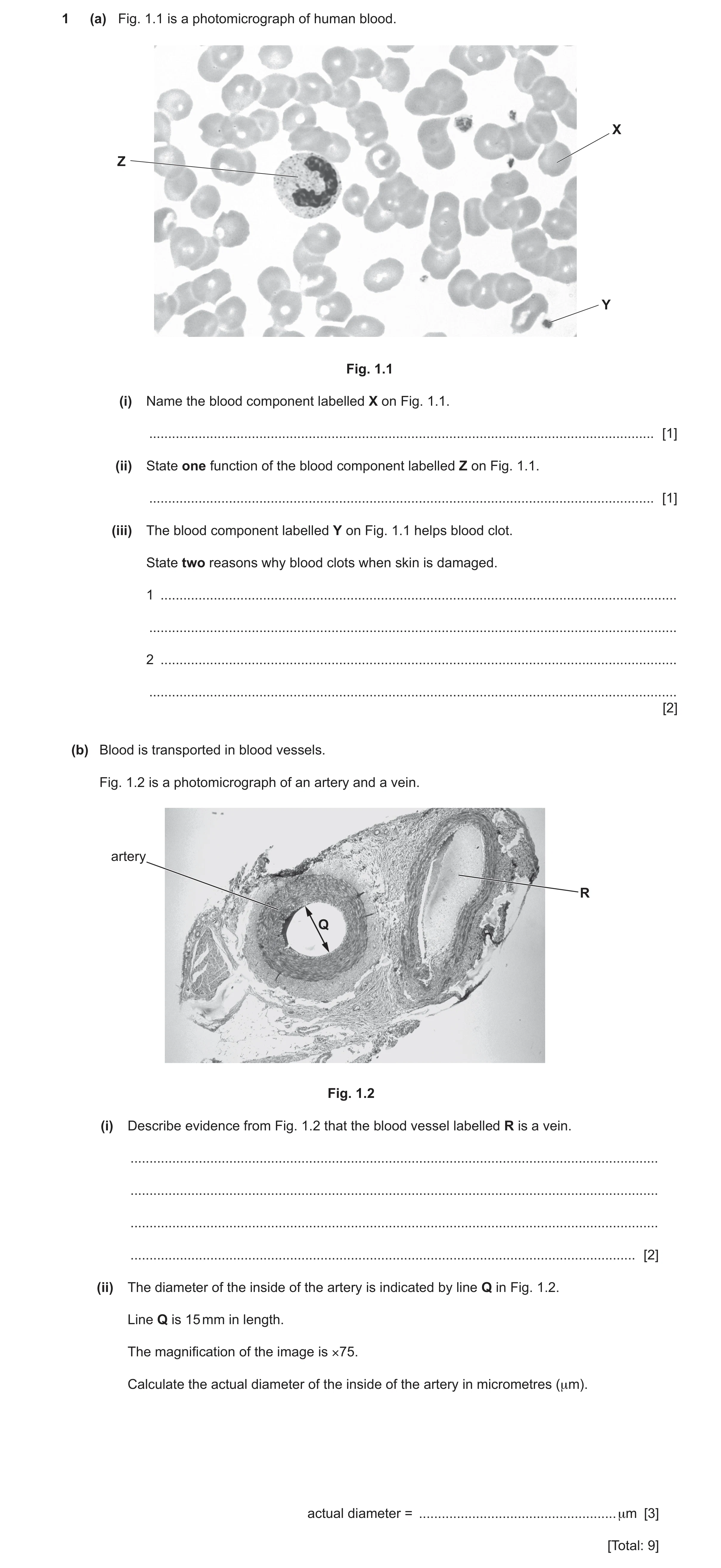 Question 10: (a) Fig. 1.1 is a photomicrograph of human blood. X Z Y Fig. 1.1 (i) Name the blood component labelled X on Fig. 1.1. .....................…