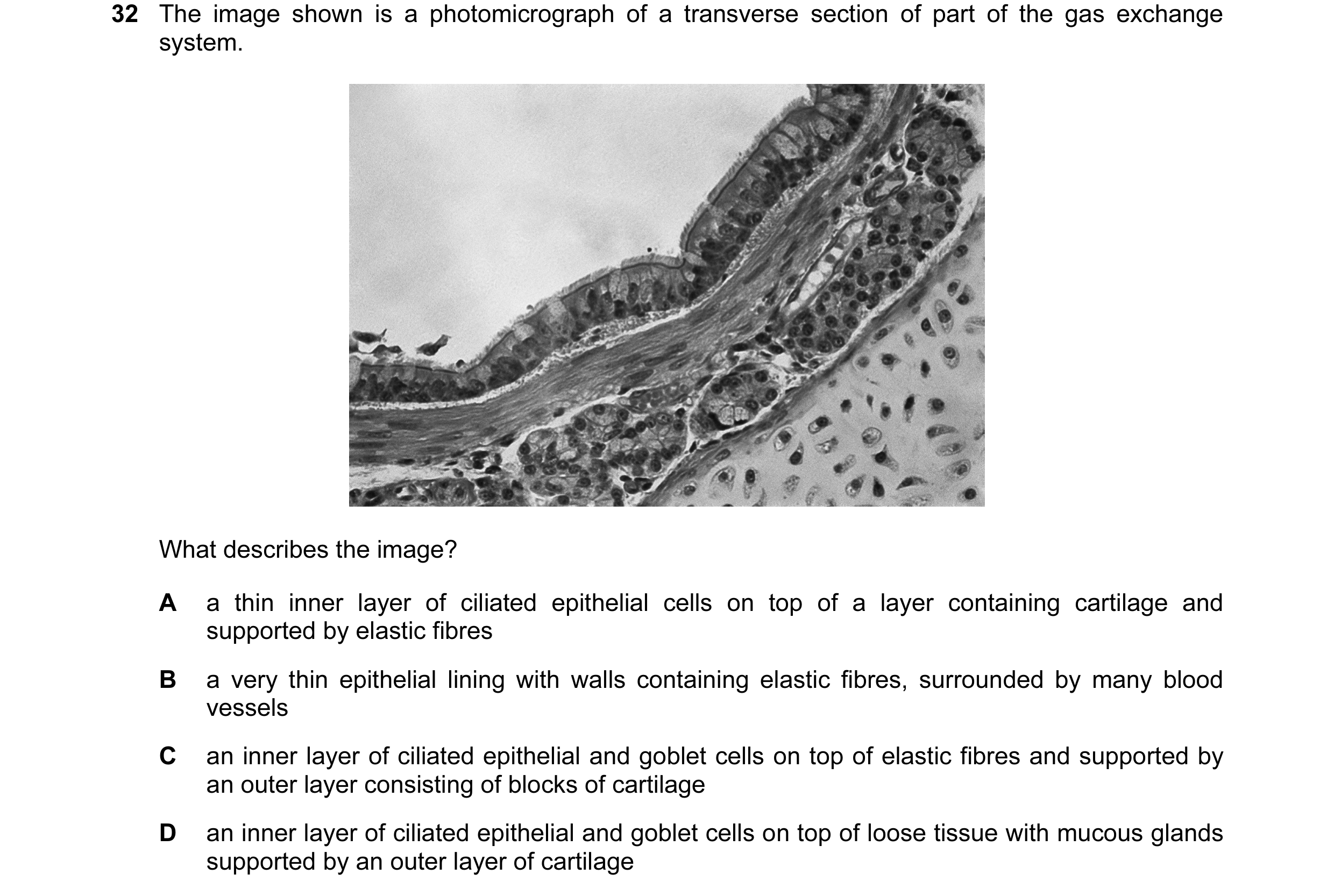 Question 121: The image shown is a photomicrograph of a transverse section of part of the gas exchange system. What describes the image? A a thin inner l…