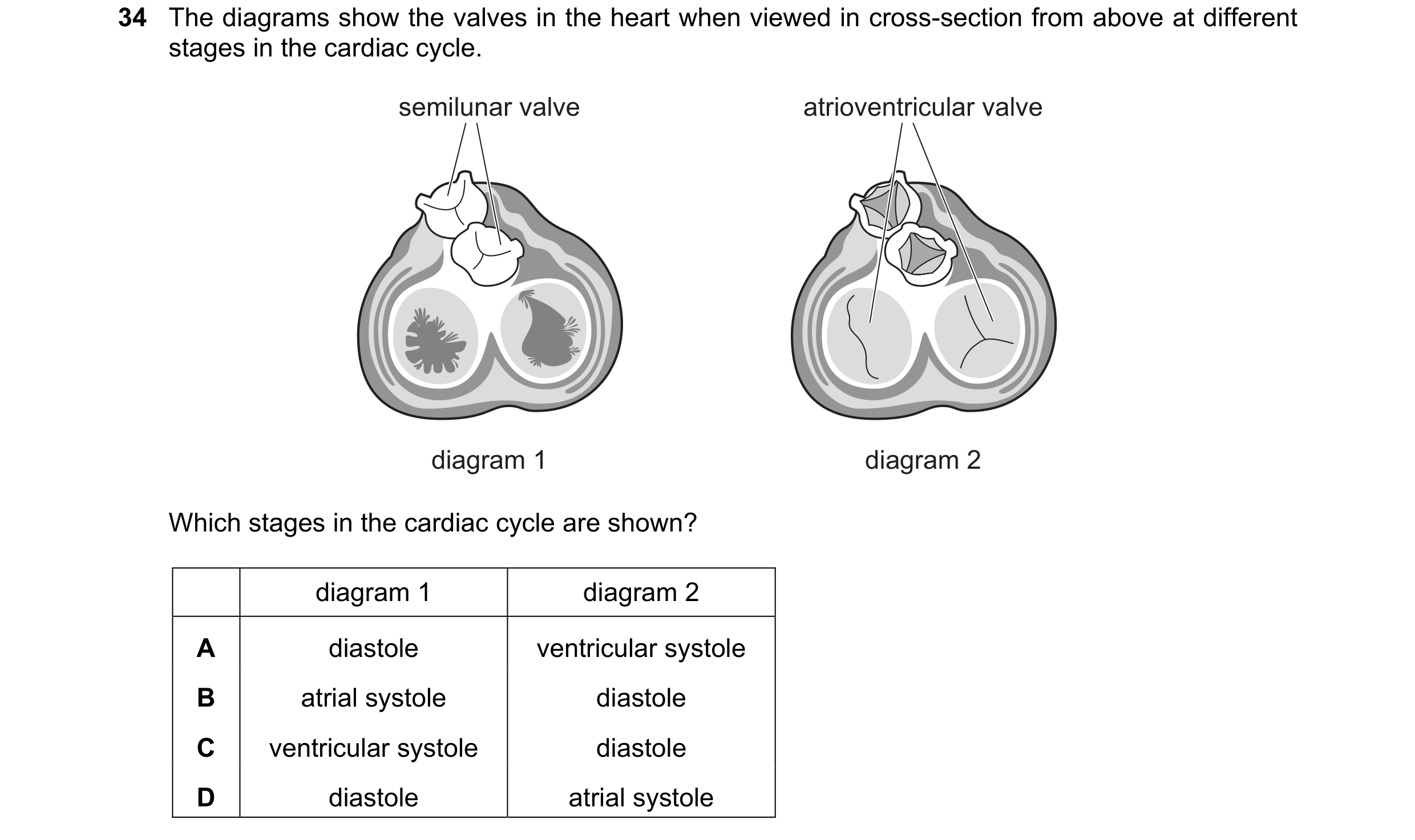 Question 125: The diagrams show the valves in the heart when viewed in cross-section from above at different stages in the cardiac cycle. semilunar valve…