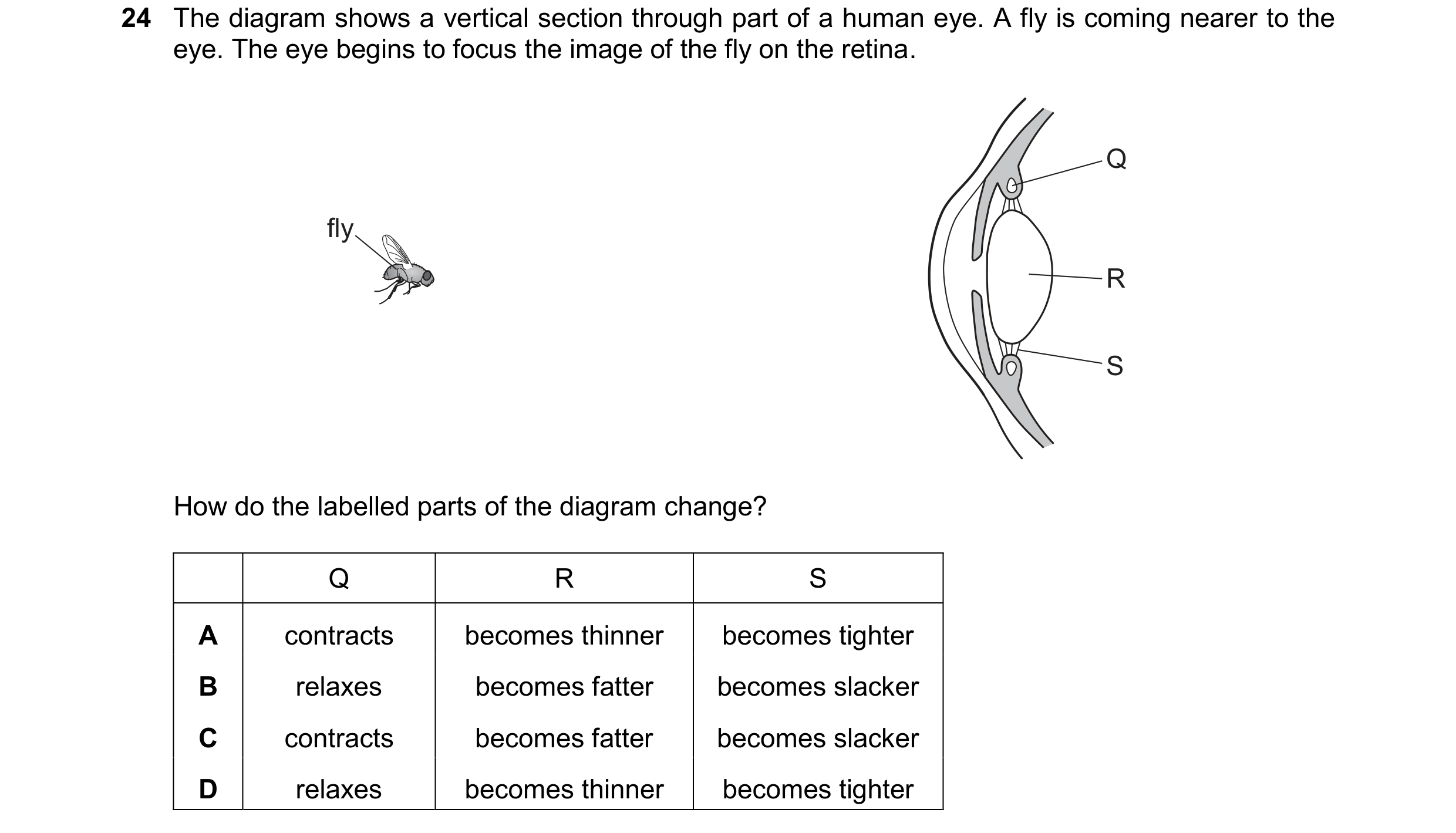Question 25: The diagram shows a vertical section through part of a human eye. A fly is coming nearer to the eye. The eye begins to focus the image of t…