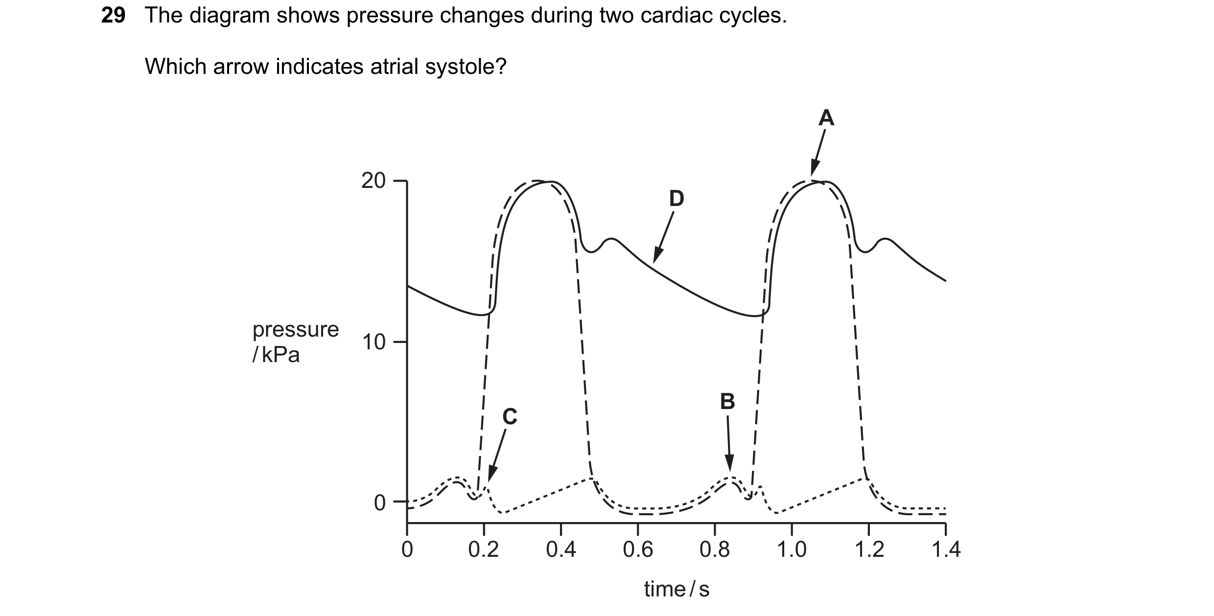 Question 134: The diagram shows pressure changes during two cardiac cycles. Which arrow indicates atrial systole? A 20 D pressure 10 / kPa B C 0 0 0.2 0.…