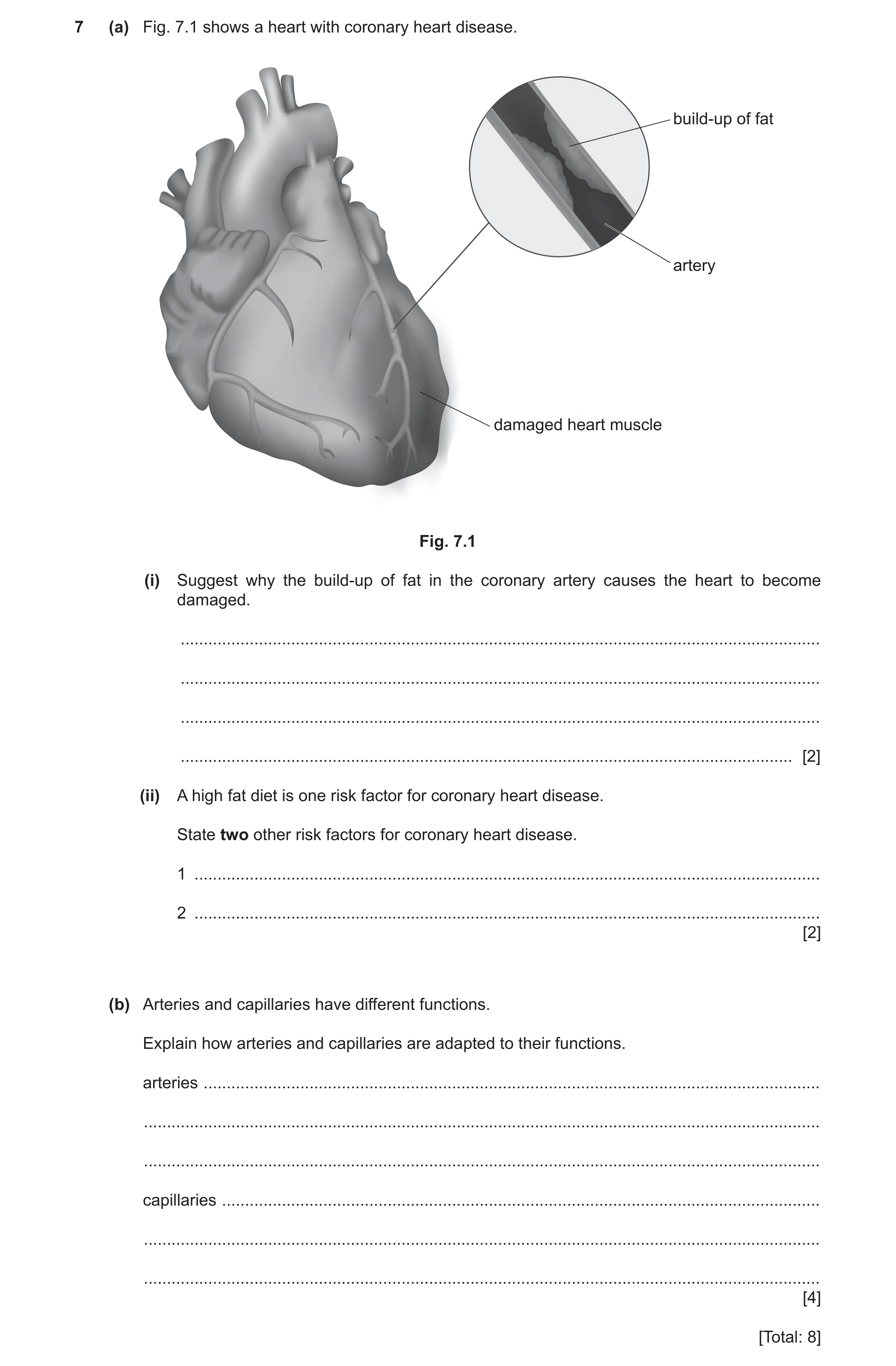 Question 11: (a) Fig. 7.1 shows a heart with coronary heart disease. build-up of fat artery damaged heart muscle Fig. 7.1 (i) Suggest why the build-up o…
