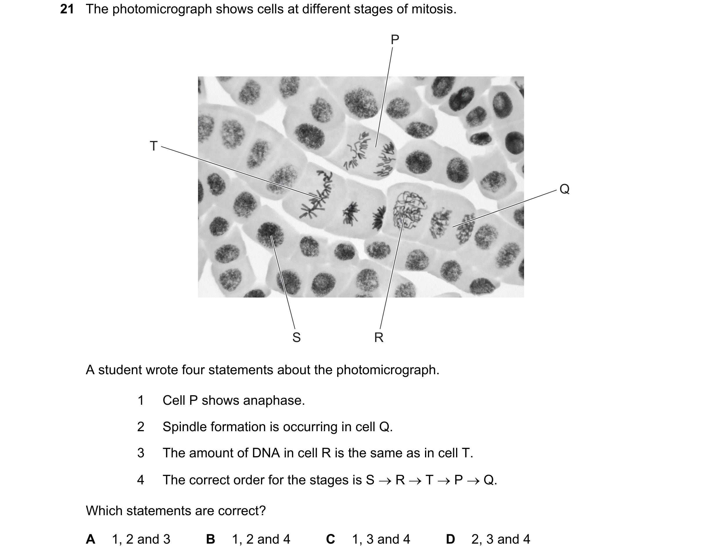 Question 99: The photomicrograph shows cells at different stages of mitosis. P T Q S R A student wrote four statements about the photomicrograph. 1 Cell…