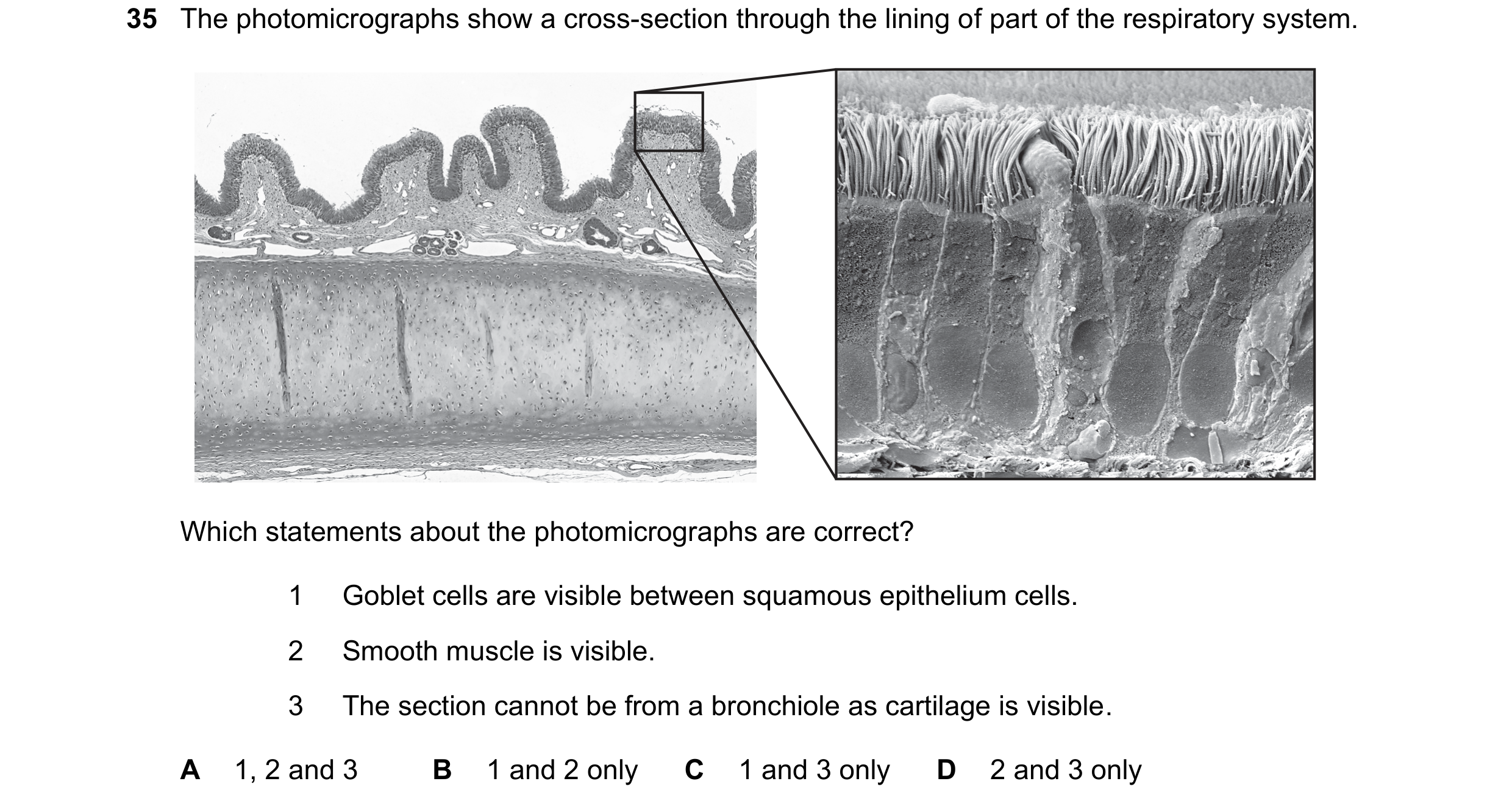 Question 214: The photomicrographs show a cross-section through the lining of part of the respiratory system. Which statements about the photomicrographs…