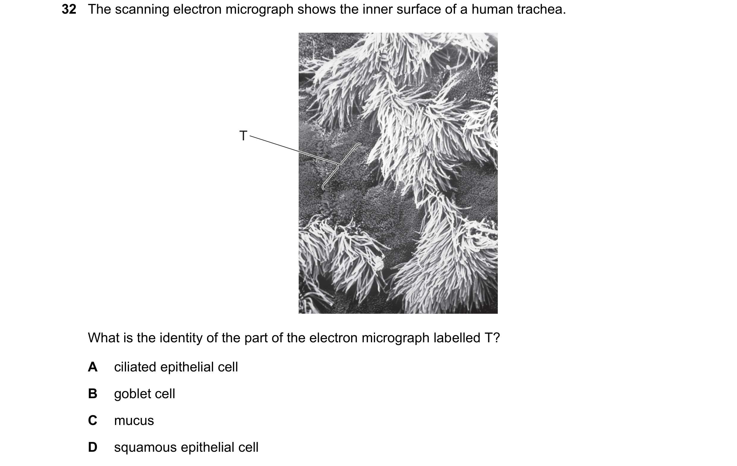 Question 261: The scanning electron micrograph shows the inner surface of a human trachea. T What is the identity of the part of the electron micrograph …