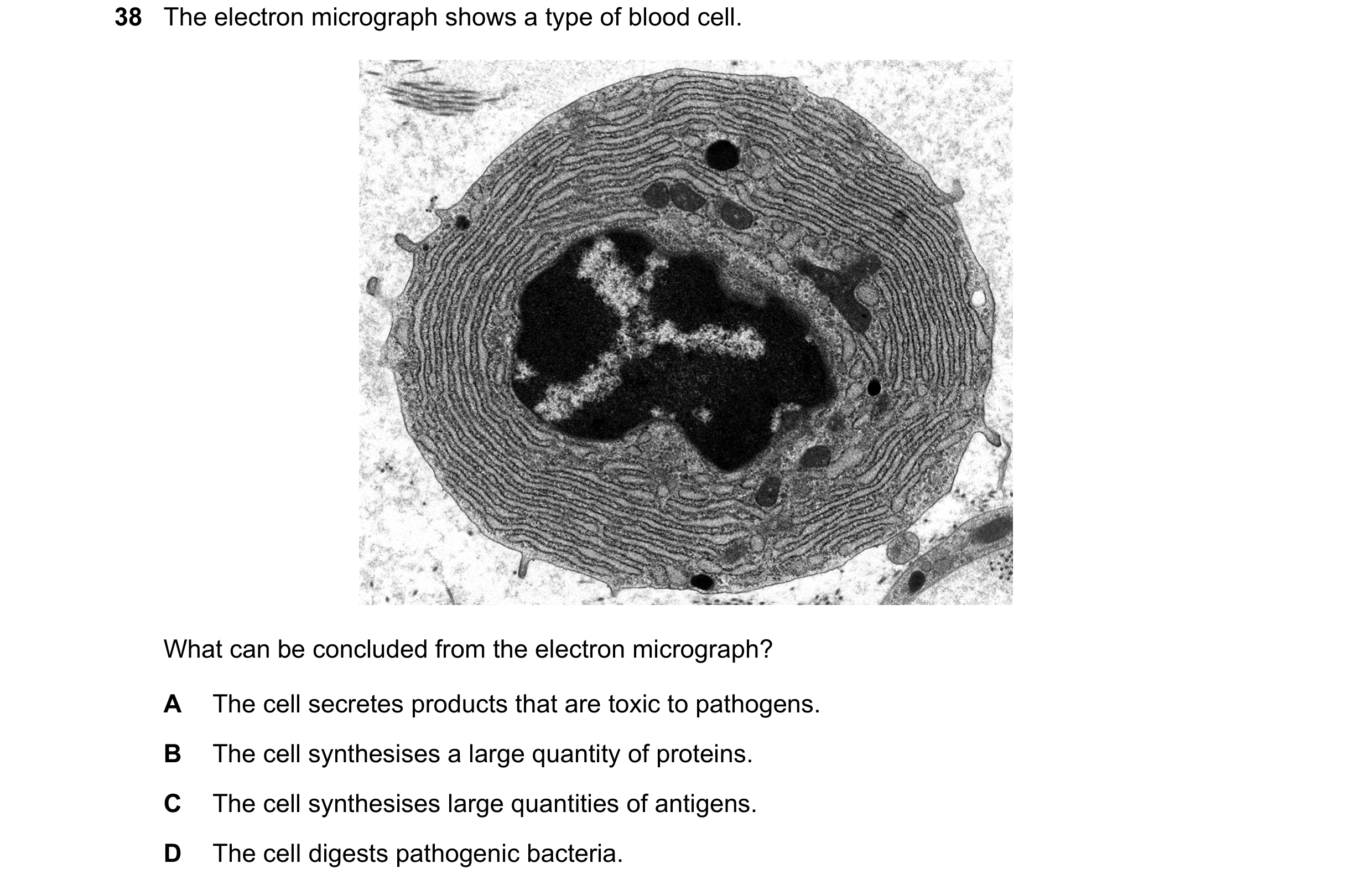 Question 131: The electron micrograph shows a type of blood cell. What can be concluded from the electron micrograph? A The cell secretes products that a…