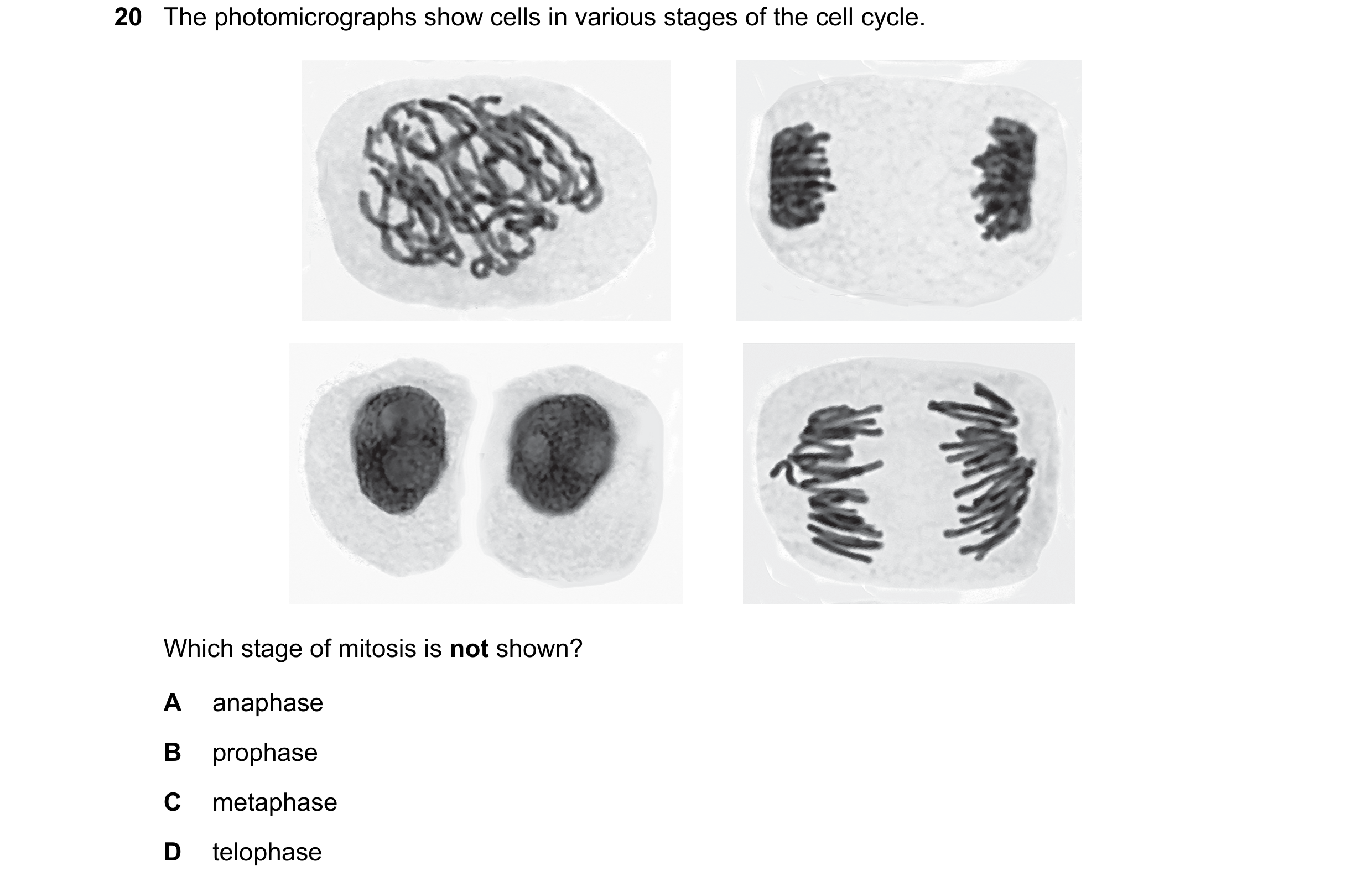 Question 96: The photomicrographs show cells in various stages of the cell cycle. Which stage of mitosis is not shown? A anaphase B prophase C metaphase…