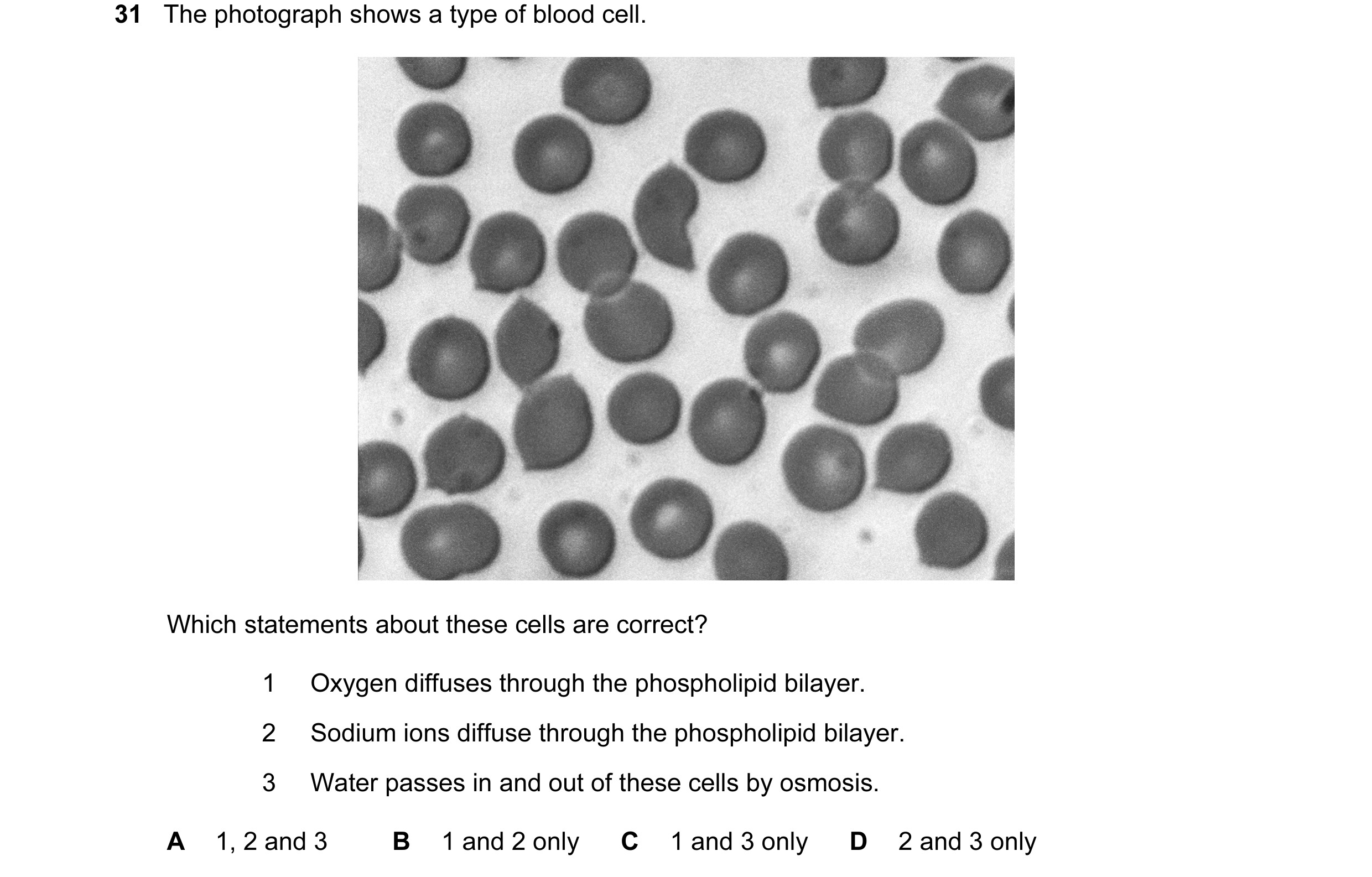 Question 111: The photograph shows a type of blood cell. Which statements about these cells are correct? 1 Oxygen diffuses through the phospholipid bilay…