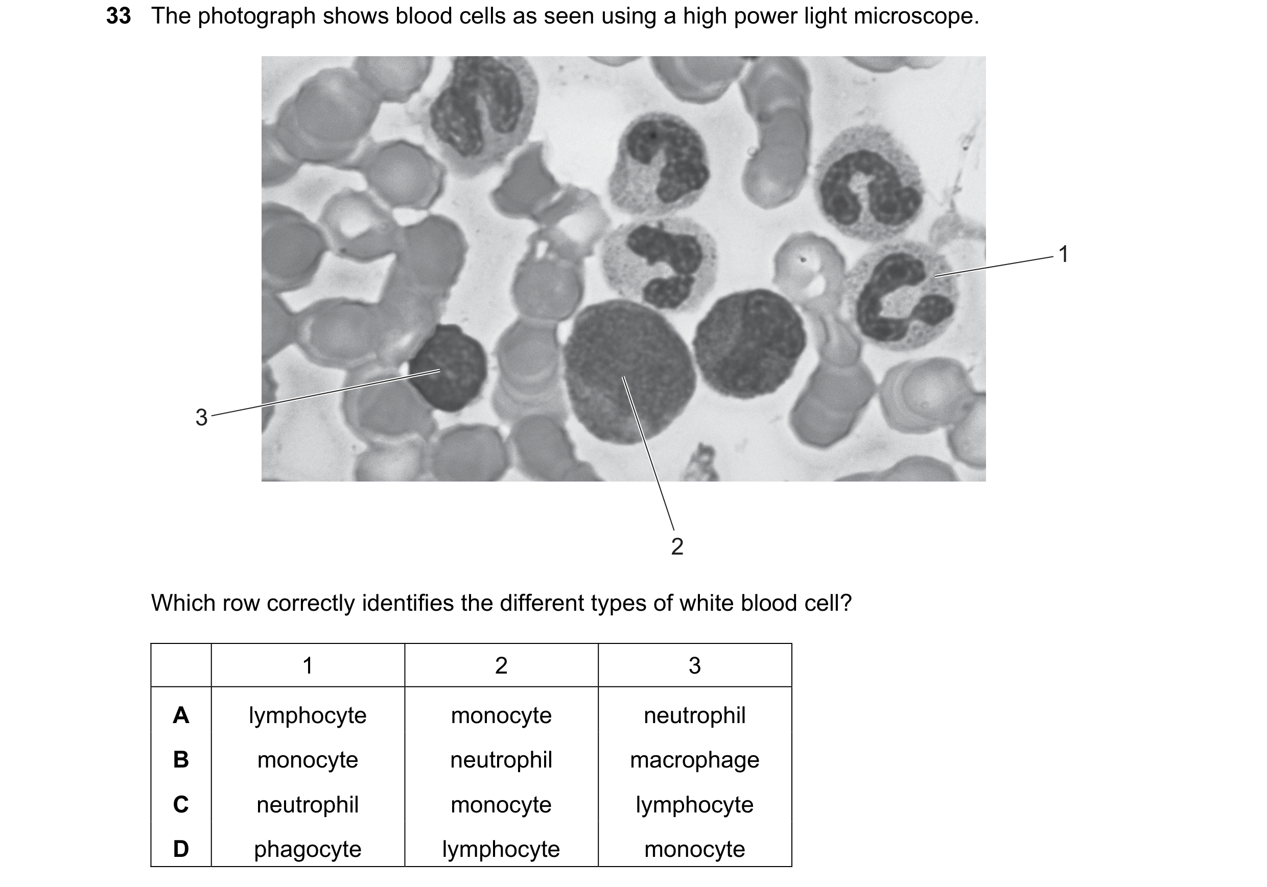 Question 73: The photograph shows blood cells as seen using a high power light microscope. 1 3 2 Which row correctly identifies the different types of w…