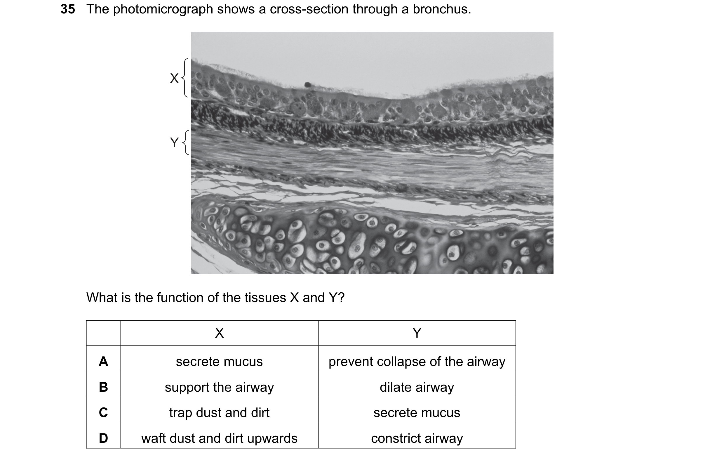 Question 138: The photomicrograph shows a cross-section through a bronchus. X Y What is the function of the tissues X and Y? X Y A secrete mucus prevent …