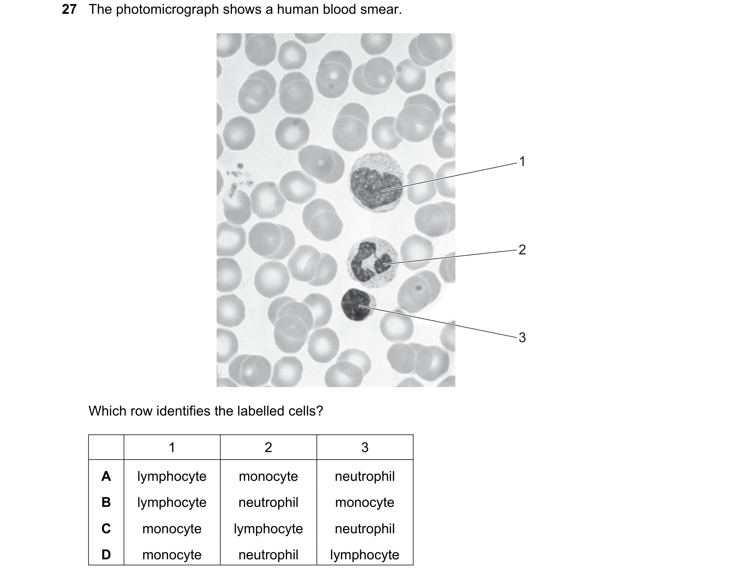 Question 79: The photomicrograph shows a human blood smear. 1 2 3 Which row identifies the labelled cells? 1 2 3 A lymphocyte monocyte neutrophil B lymp…
