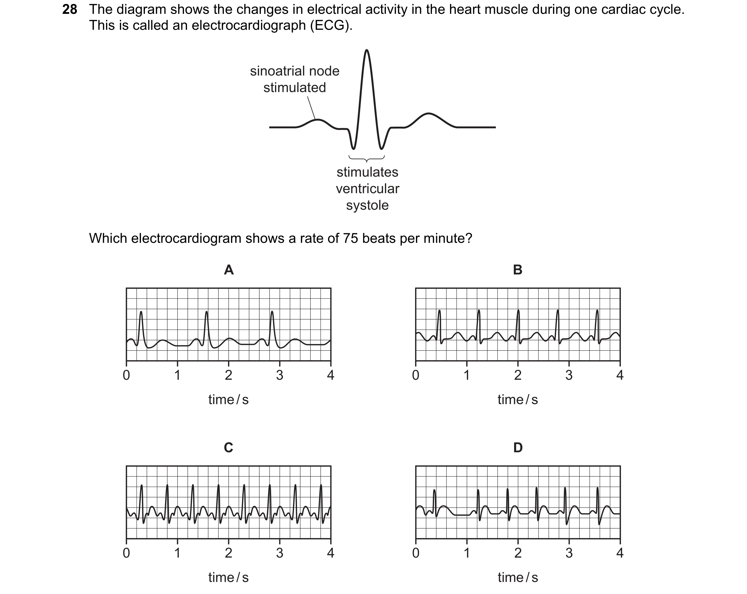 Question 74: The diagram shows the changes in electrical activity in the heart muscle during one cardiac cycle. This is called an electrocardiograph (EC…