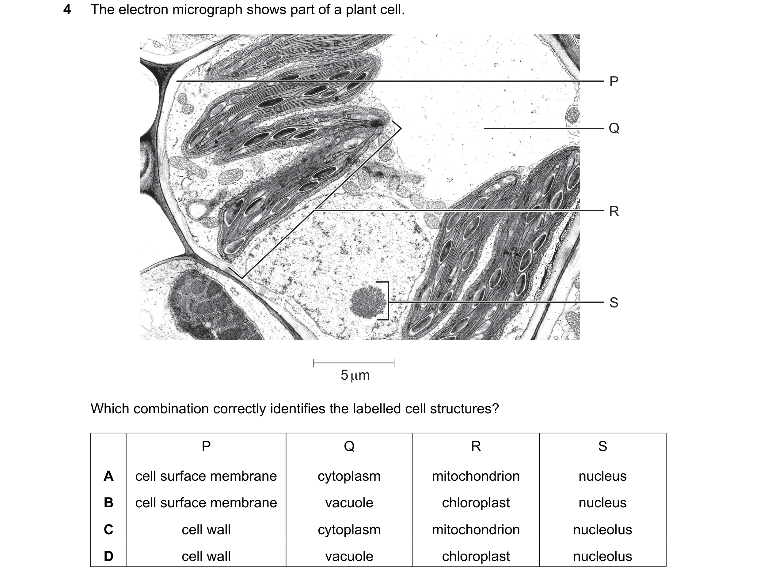 Question 231: The electron micrograph shows part of a plant cell. P Q R S 5 μm Which combination correctly identifies the labelled cell structures? P Q R…