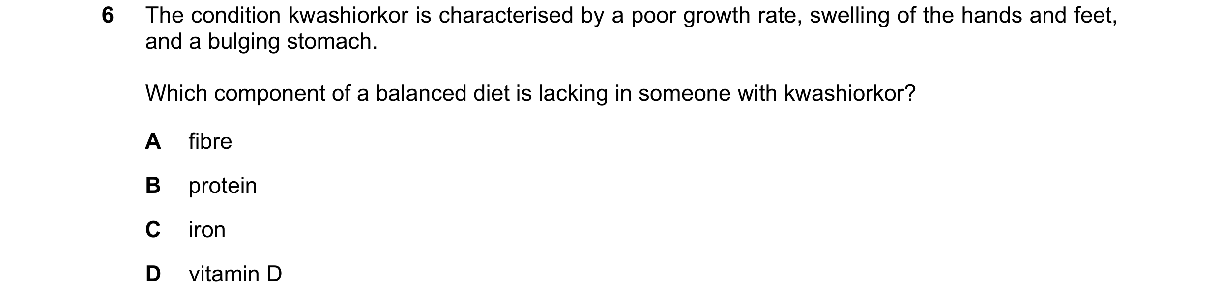 Question 10: The condition kwashiorkor is characterised by a poor growth rate, swelling of the hands and feet, and a bulging stomach. Which component of…