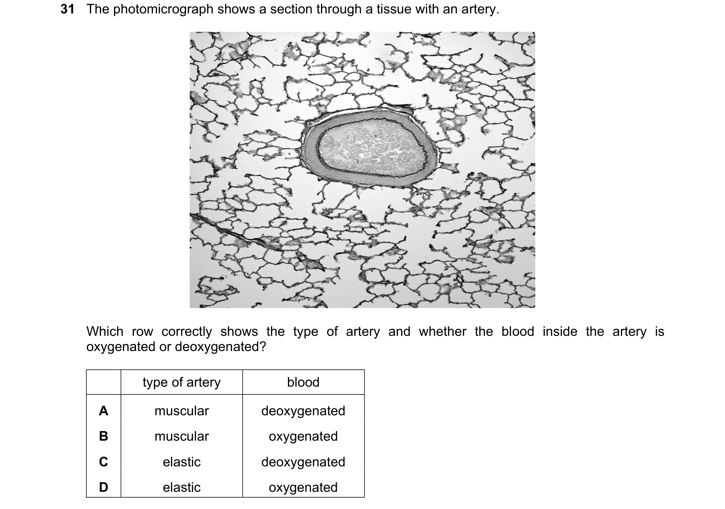 Question 133: The photomicrograph shows a section through a tissue with an artery. Which row correctly shows the type of artery and whether the blood ins…