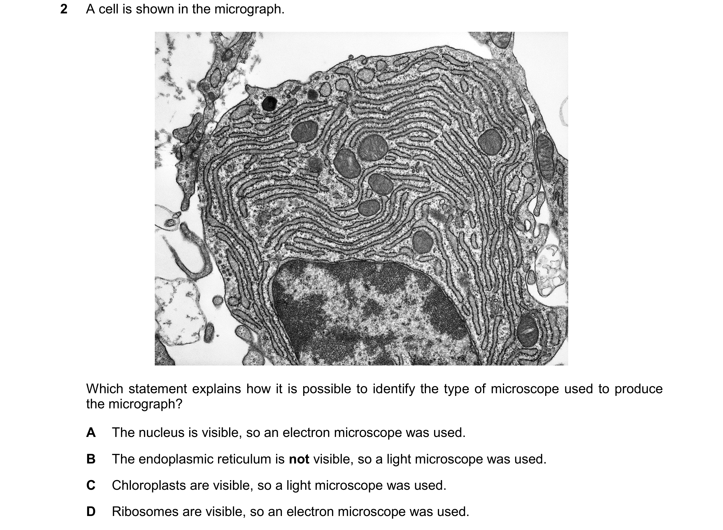 Question 183: A cell is shown in the micrograph. Which statement explains how it is possible to identify the type of microscope used to produce the micro…