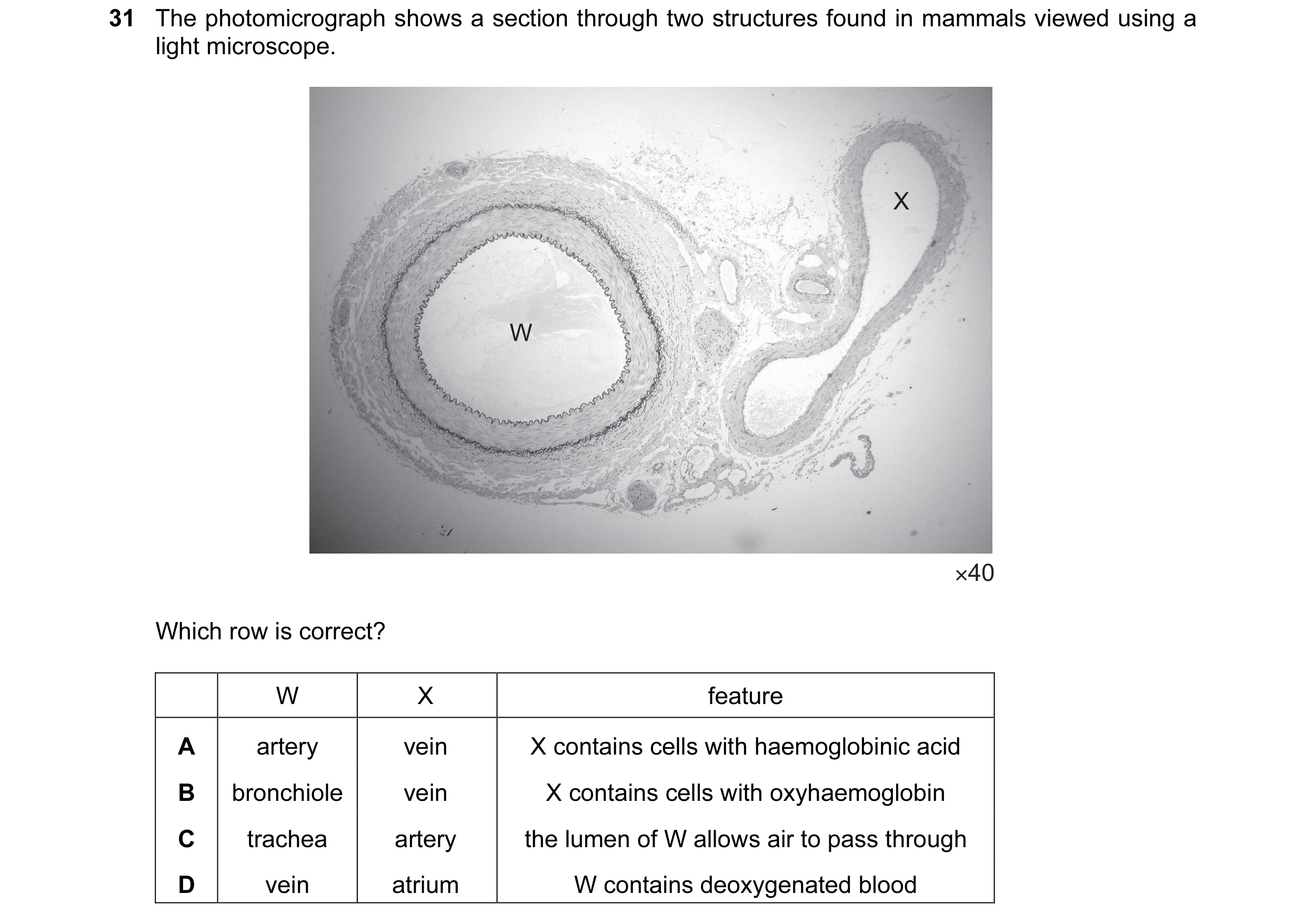 Question 46: The photomicrograph shows a section through two structures found in mammals viewed using a light microscope. X W ×40 Which row is correct? …