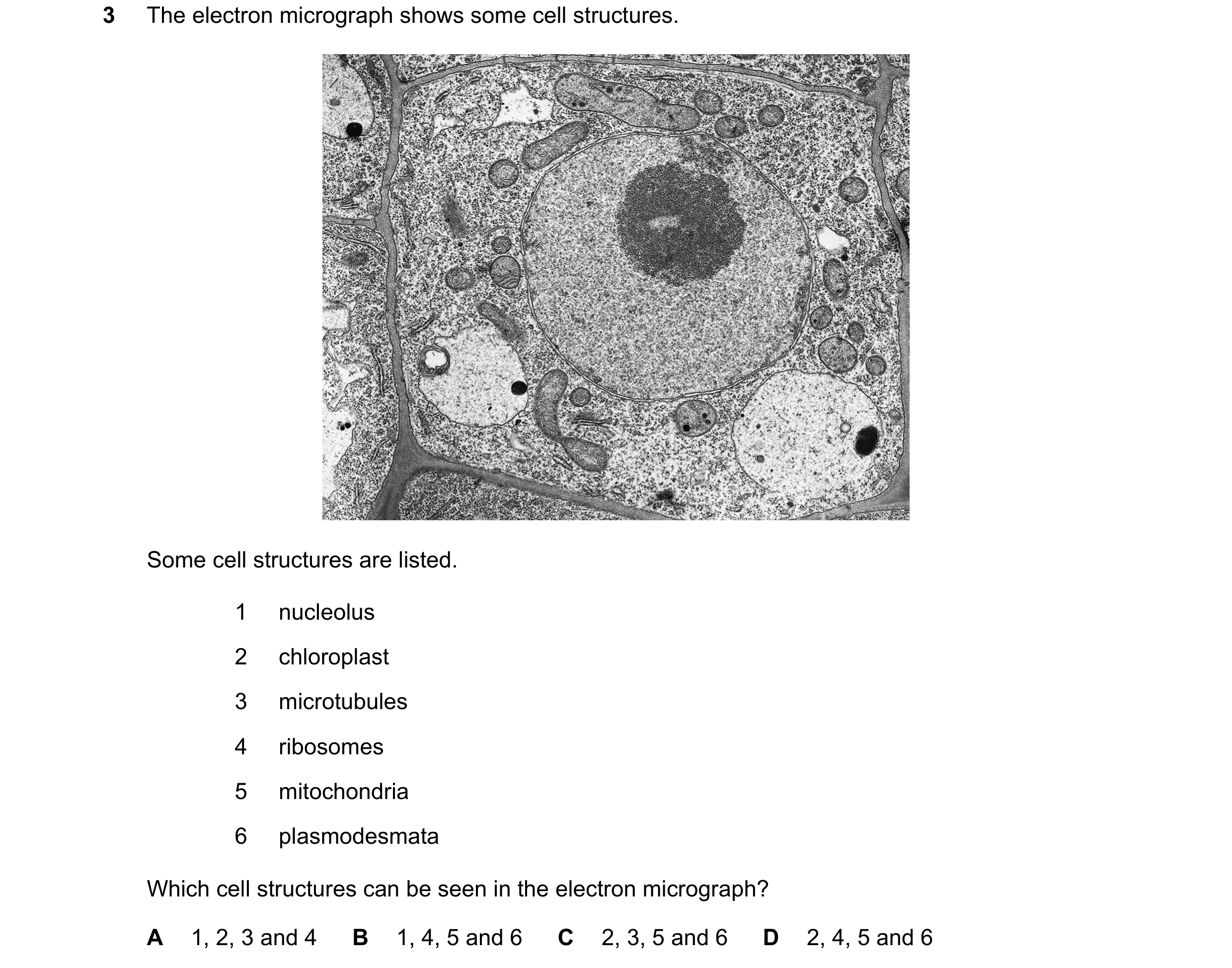 Question 142: The electron micrograph shows some cell structures. Some cell structures are listed. 1 nucleolus 2 chloroplast 3 microtubules 4 ribosomes 5…