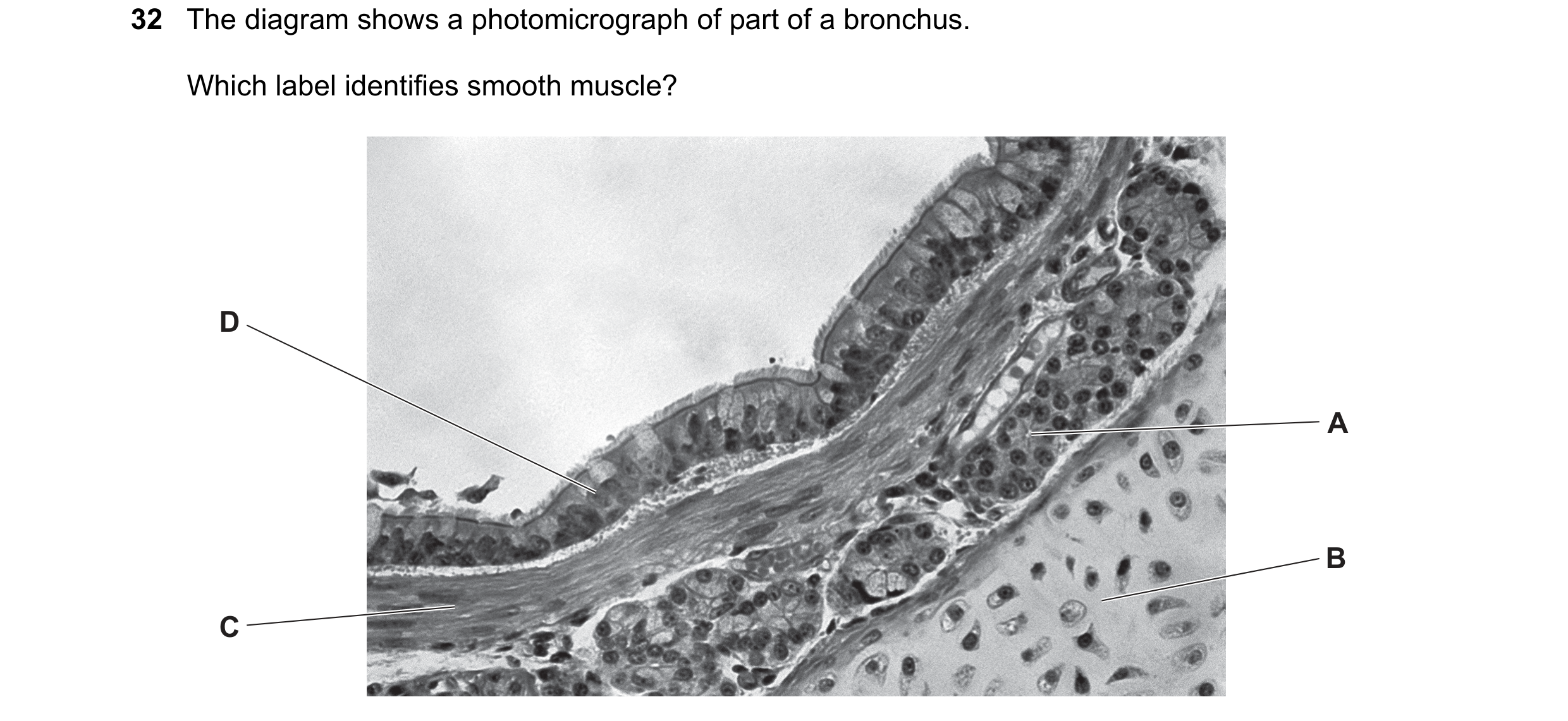 Question 190: The diagram shows a photomicrograph of part of a bronchus. Which label identifies smooth muscle? D A B C