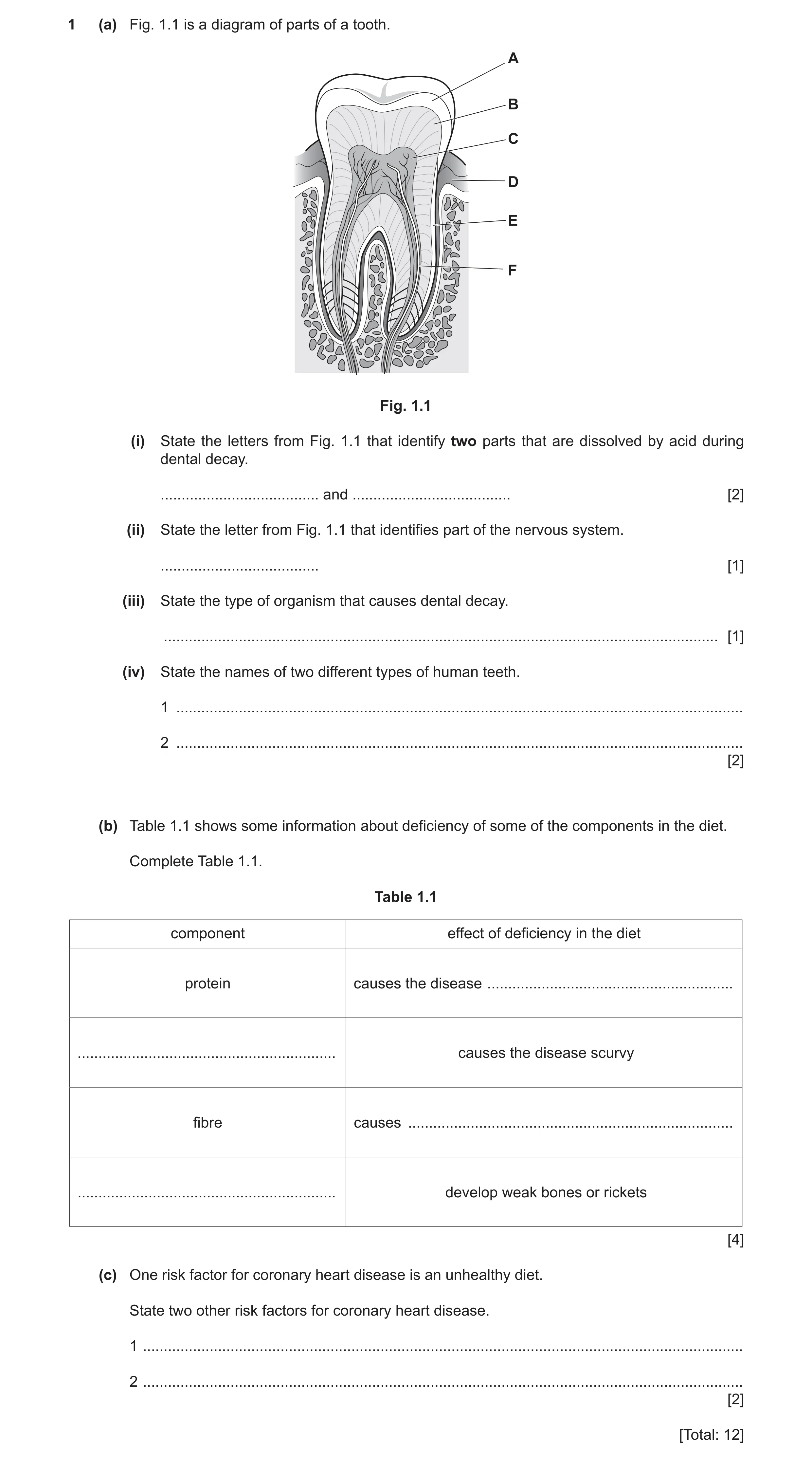 Question 9: (a) Fig. 1.1 is a diagram of parts of a tooth. A B C D E F Fig. 1.1 (i) State the letters from Fig. 1.1 that identify two parts that are di…