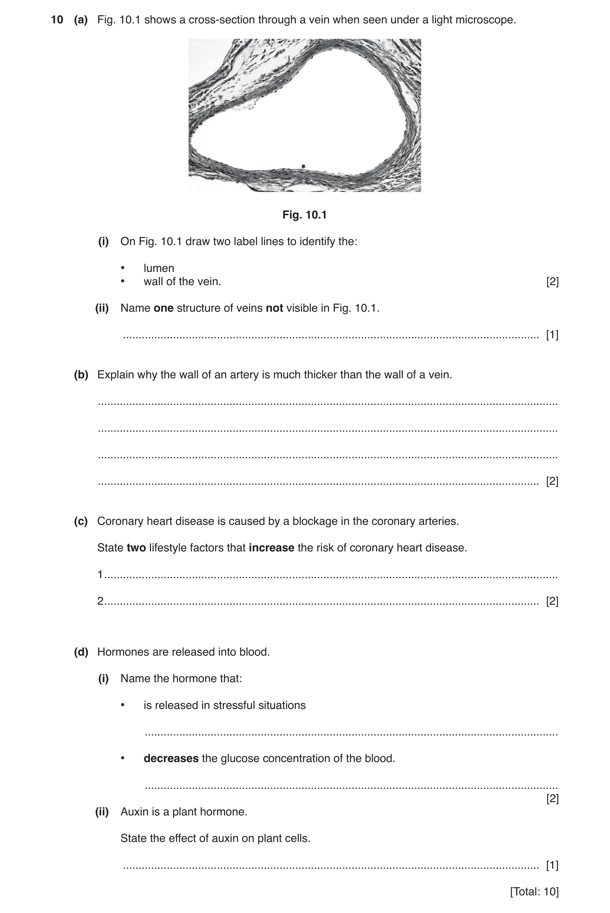 Question 2: (a) Fig. 10.1 shows a cross-section through a vein when seen under a light microscope. Fig. 10.1 (i) On Fig. 10.1 draw two label lines to i…