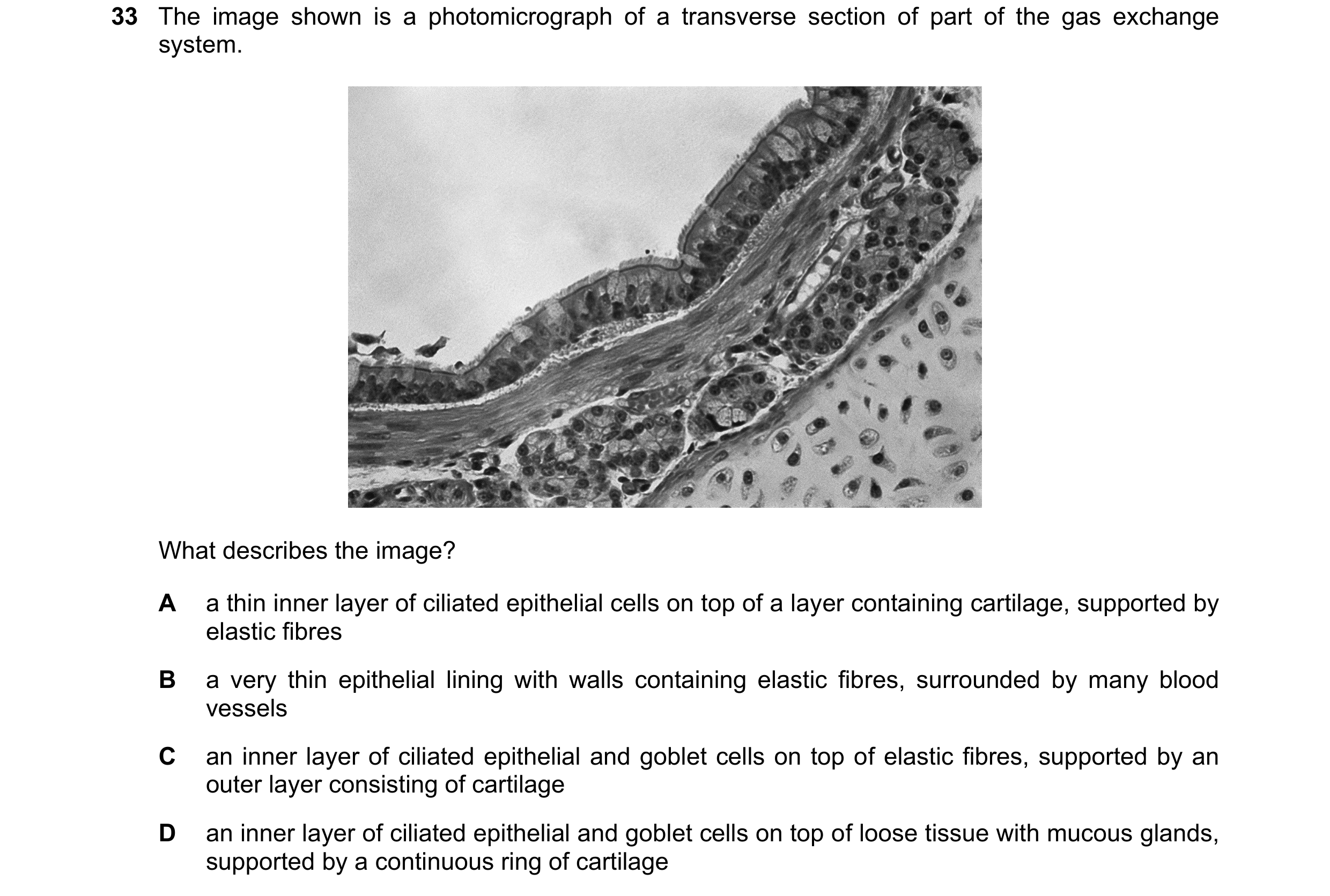 Question 204: The image shown is a photomicrograph of a transverse section of part of the gas exchange system. What describes the image? A a thin inner l…