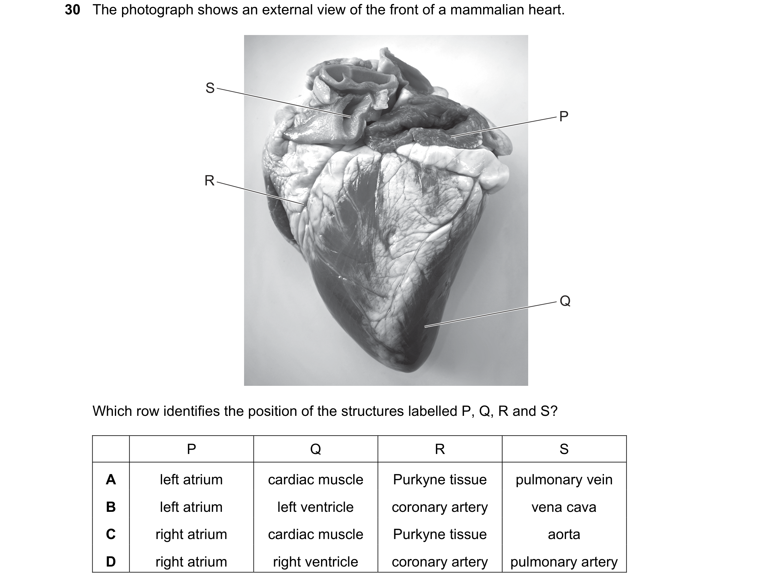 Question 82: The photograph shows an external view of the front of a mammalian heart. S P R Q Which row identifies the position of the structures labell…