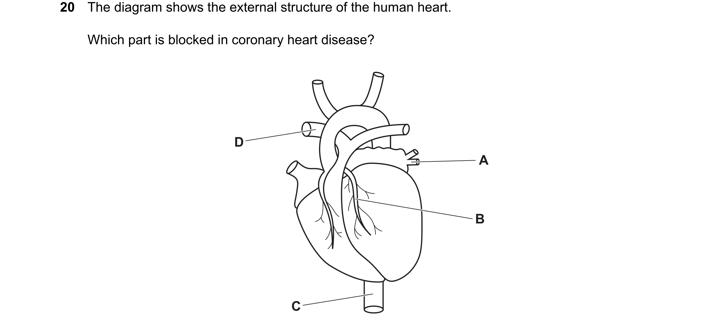 Question 16: The diagram shows the external structure of the human heart. Which part is blocked in coronary heart disease? D A B C