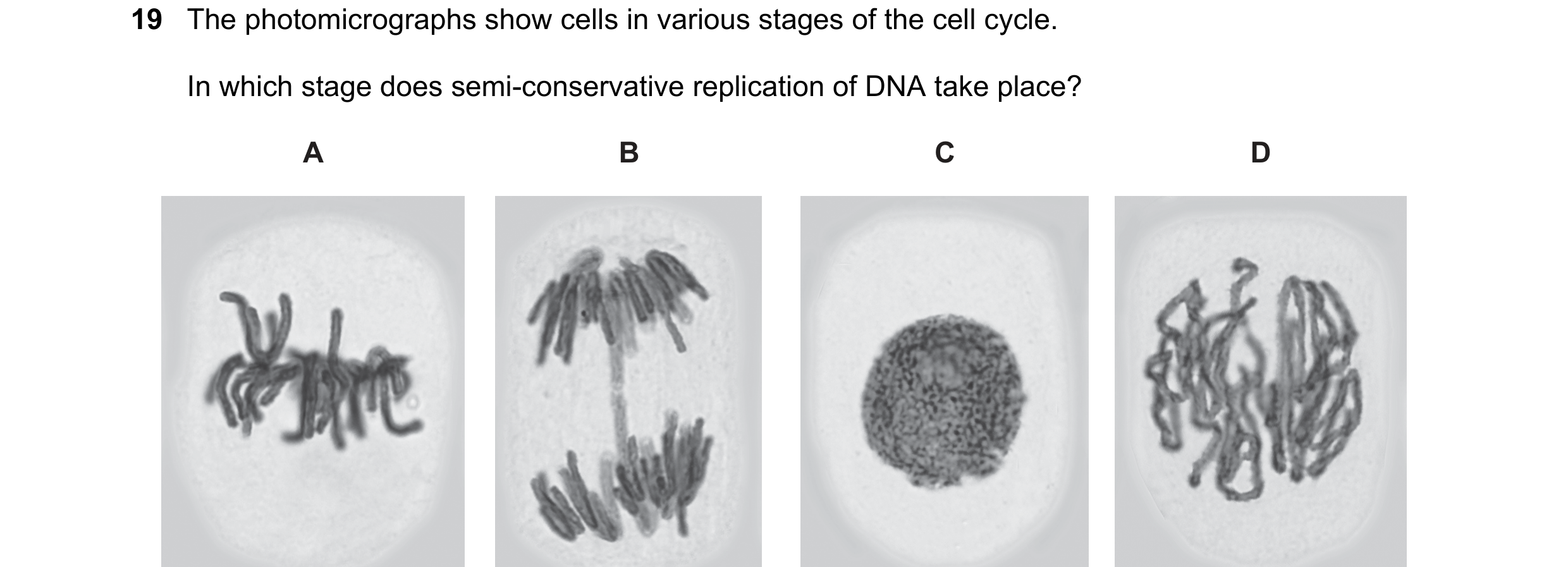 Question 87: The photomicrographs show cells in various stages of the cell cycle. In which stage does semi-conservative replication of DNA take place? A…