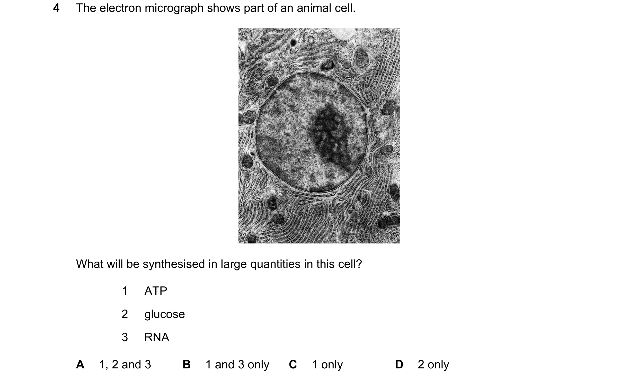 Question 8: The electron micrograph shows part of an animal cell. What will be synthesised in large quantities in this cell? 1 ATP 2 glucose 3 RNA A 1,…