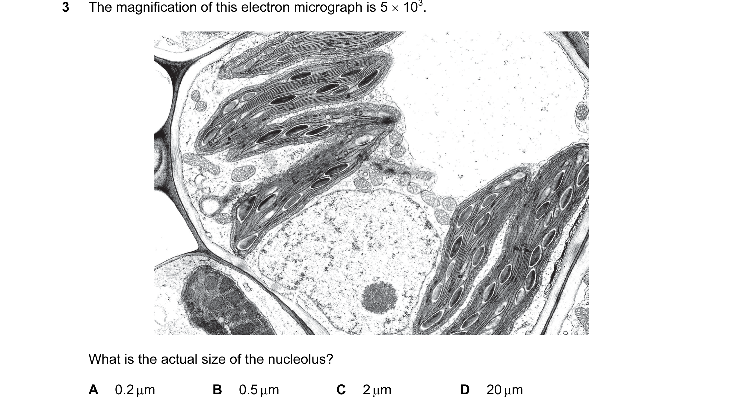 Question 12: The magnification of this electron micrograph is 5 × 103. What is the actual size of the nucleolus? A 0.2 µm B 0.5 µm C 2 µm D 20 µm