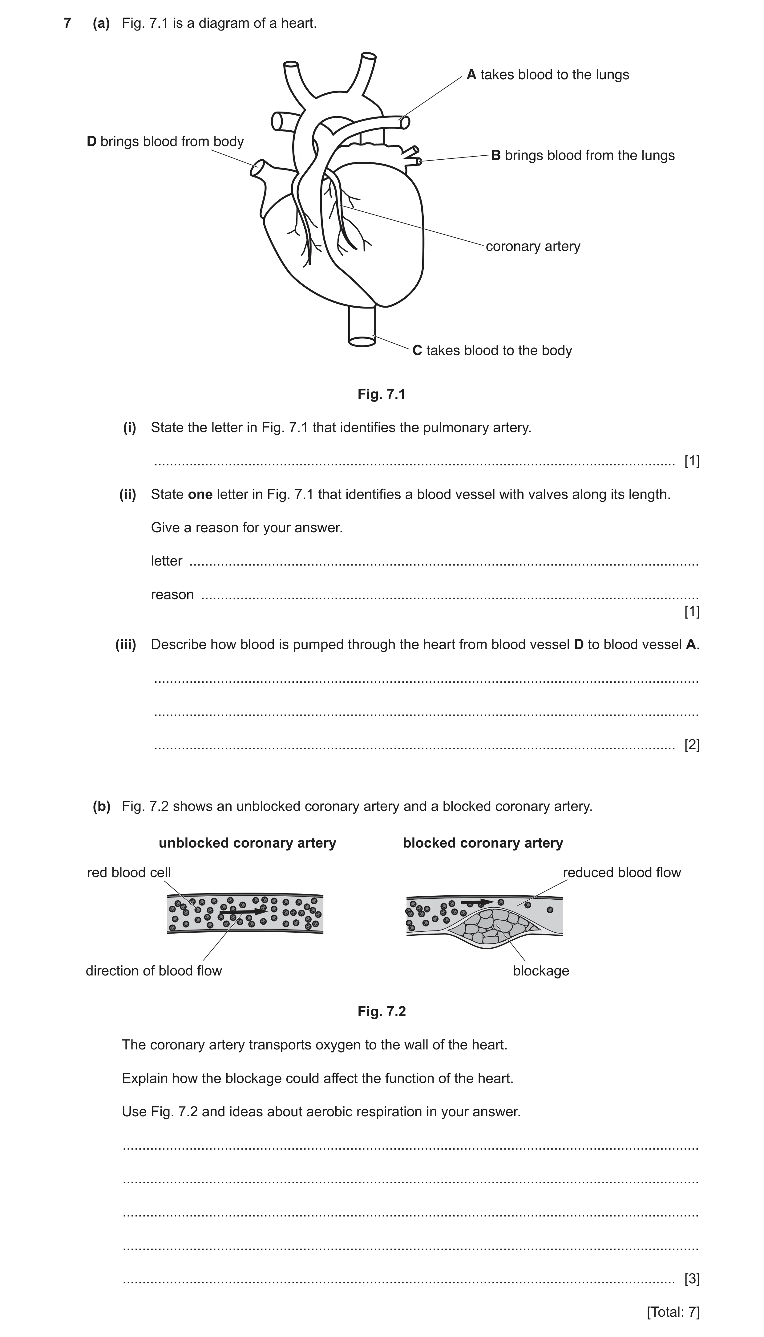 Question 16: (a) Fig. 7.1 is a diagram of a heart. A takes blood to the lungs D brings blood from body B brings blood from the lungs coronary artery C t…