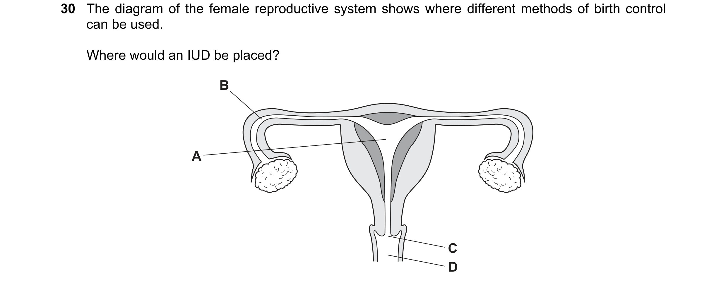 Question 9: The diagram of the female reproductive system shows where different methods of birth control can be used. Where would an IUD be placed? B A…