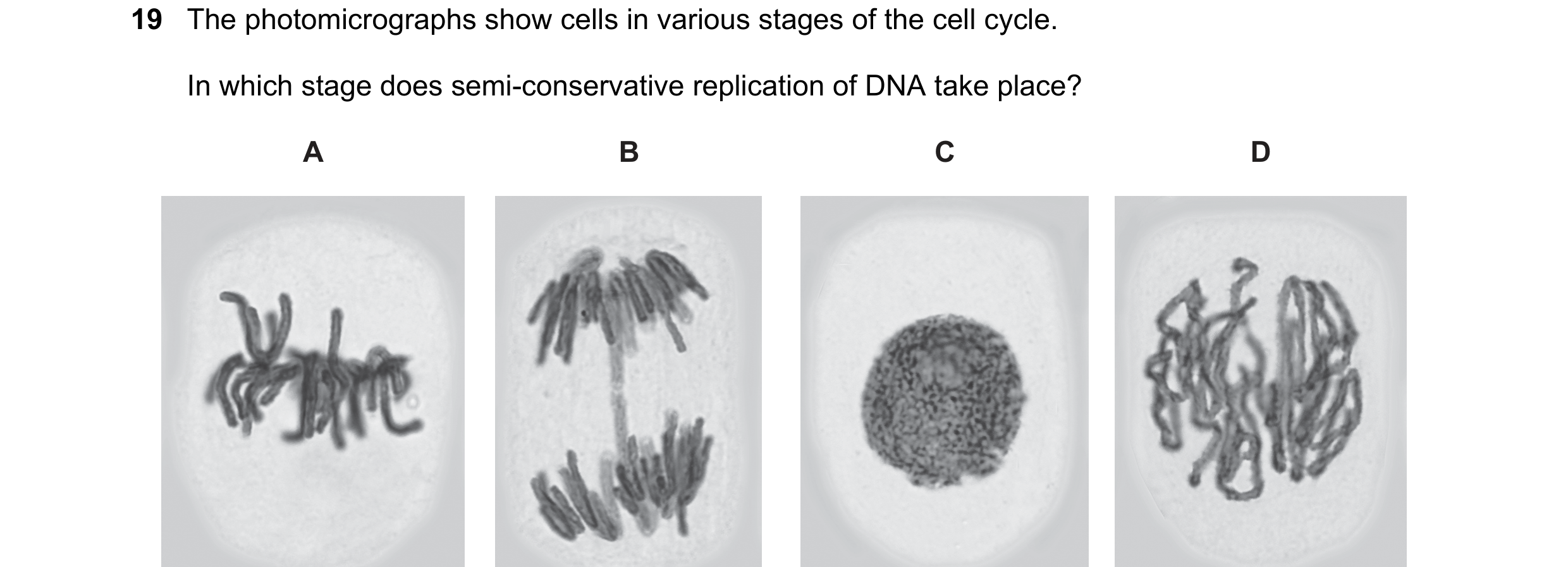 Question 156: The photomicrographs show cells in various stages of the cell cycle. In which stage does semi-conservative replication of DNA take place? A…