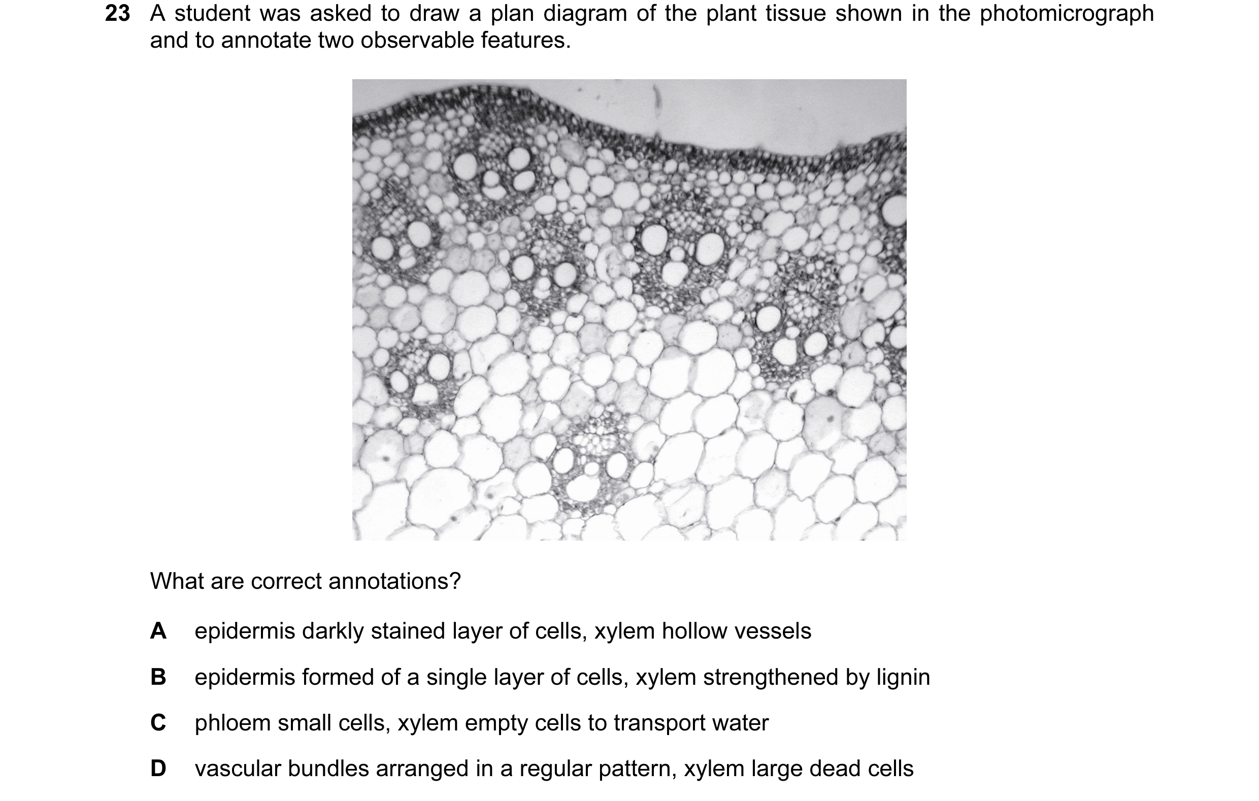Question 41: A student was asked to draw a plan diagram of the plant tissue shown in the photomicrograph and to annotate two observable features. What a…