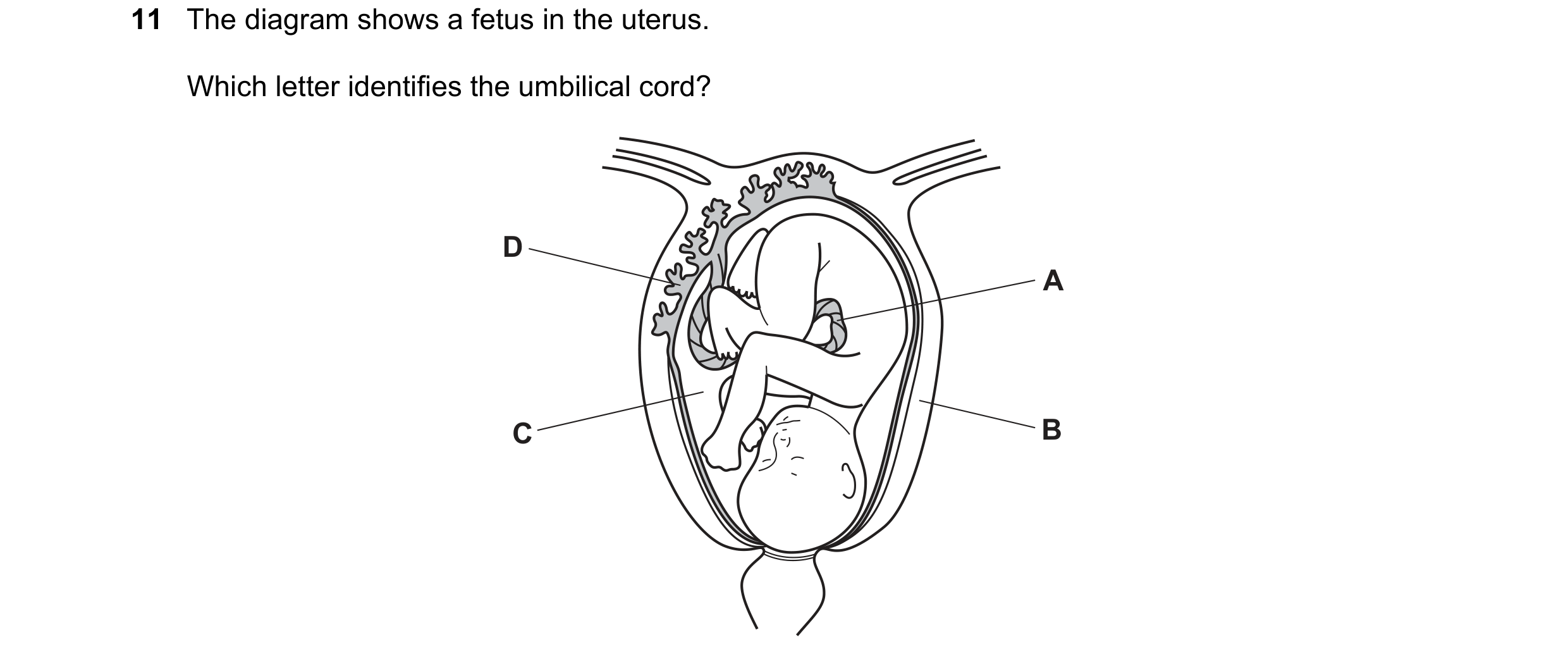 Question 30: The diagram shows a fetus in the uterus. Which letter identifies the umbilical cord? D A C B