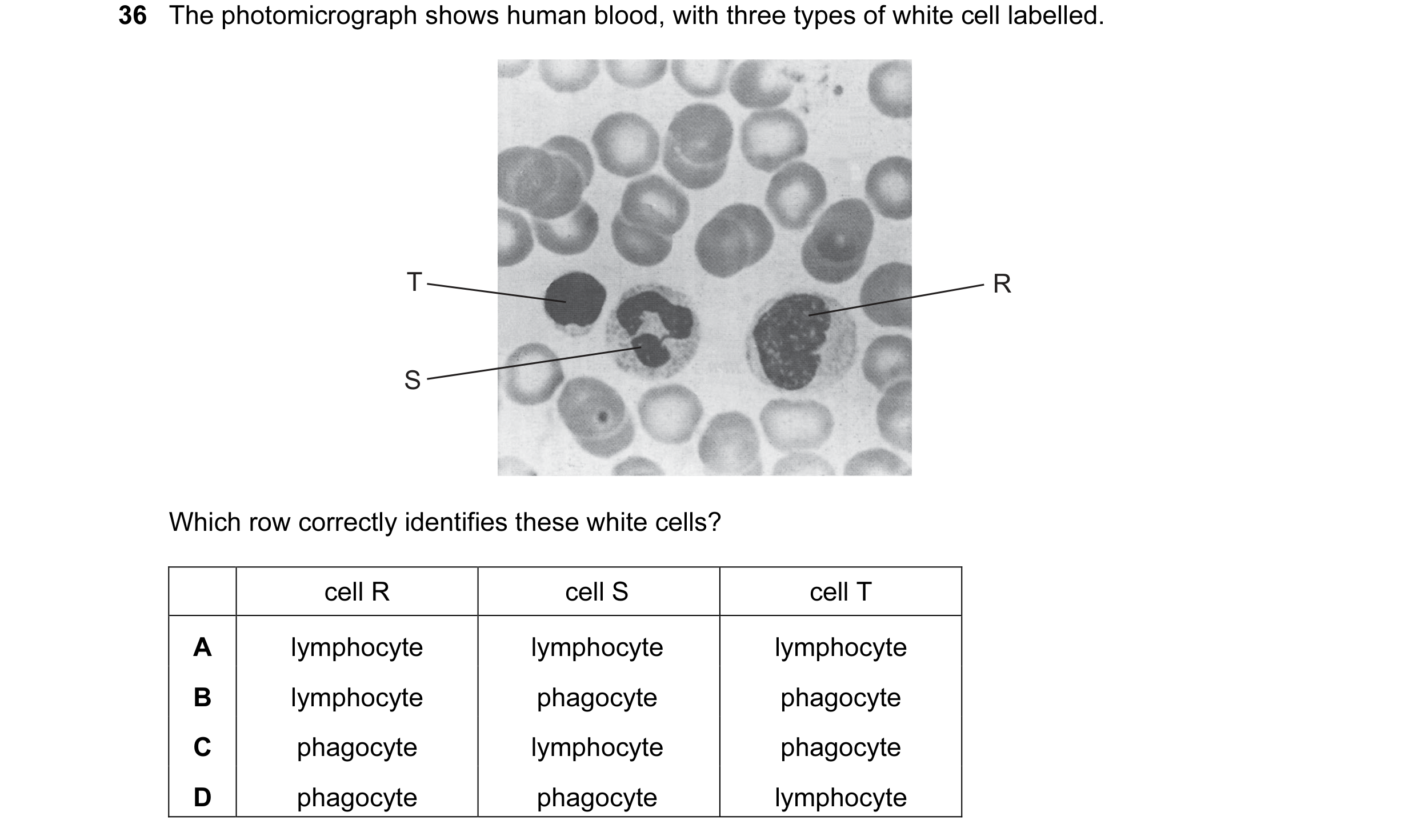 Question 36: The photomicrograph shows human blood, with three types of white cell labelled. T R S Which row correctly identifies these white cells? cel…