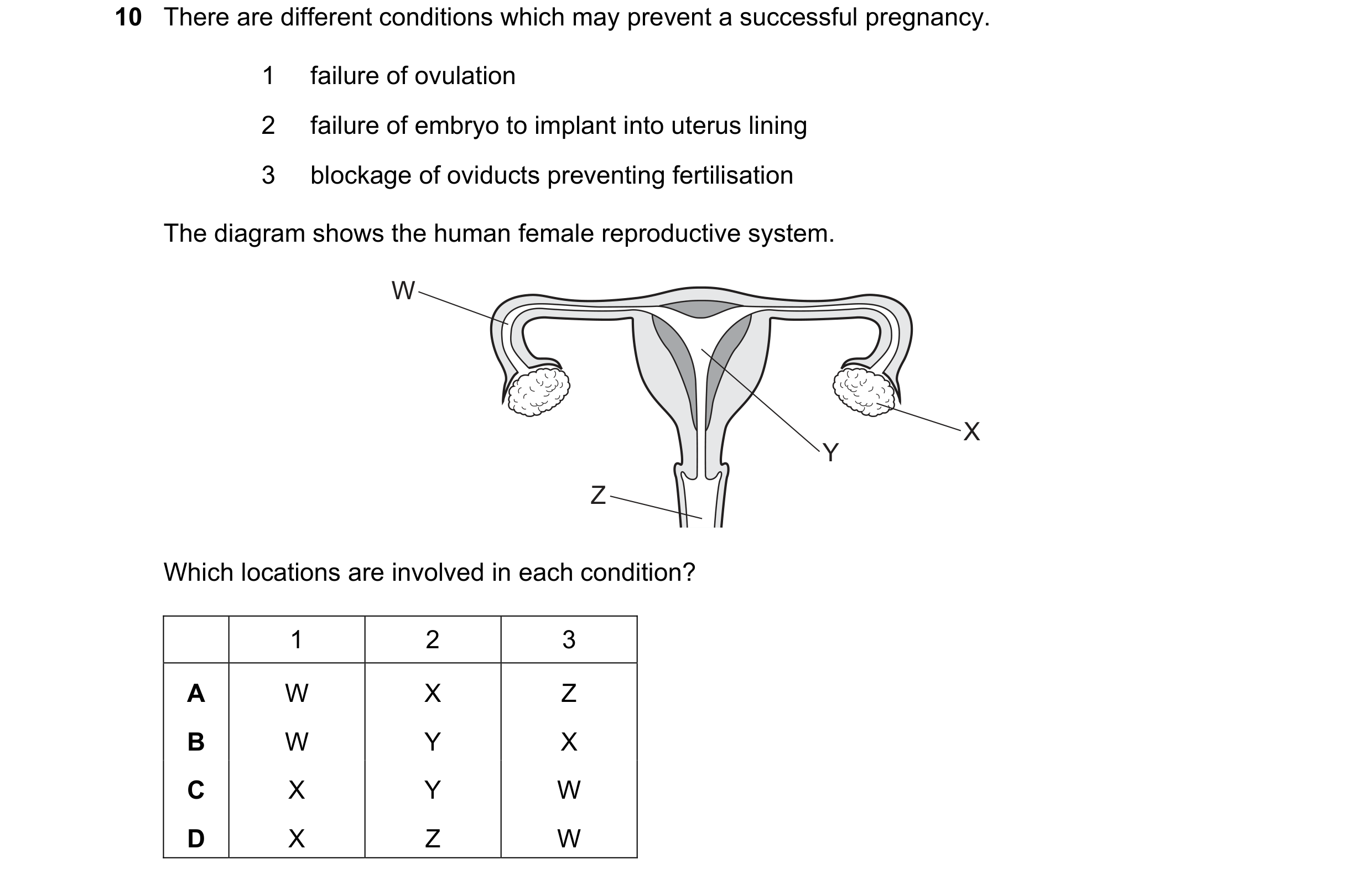 Question 63: There are different conditions which may prevent a successful pregnancy. 1 failure of ovulation 2 failure of embryo to implant into uterus …
