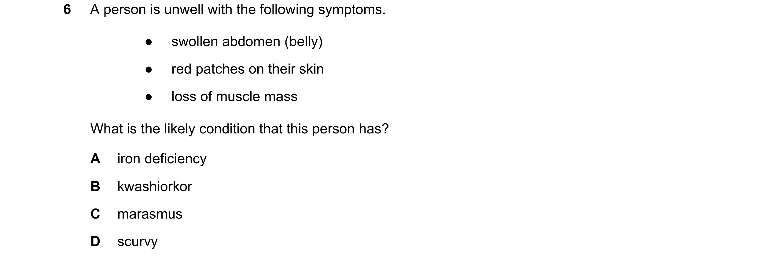 Question 12: A person is unwell with the following symptoms. ● swollen abdomen (belly) ● red patches on their skin ● loss of muscle mass What is the lik…