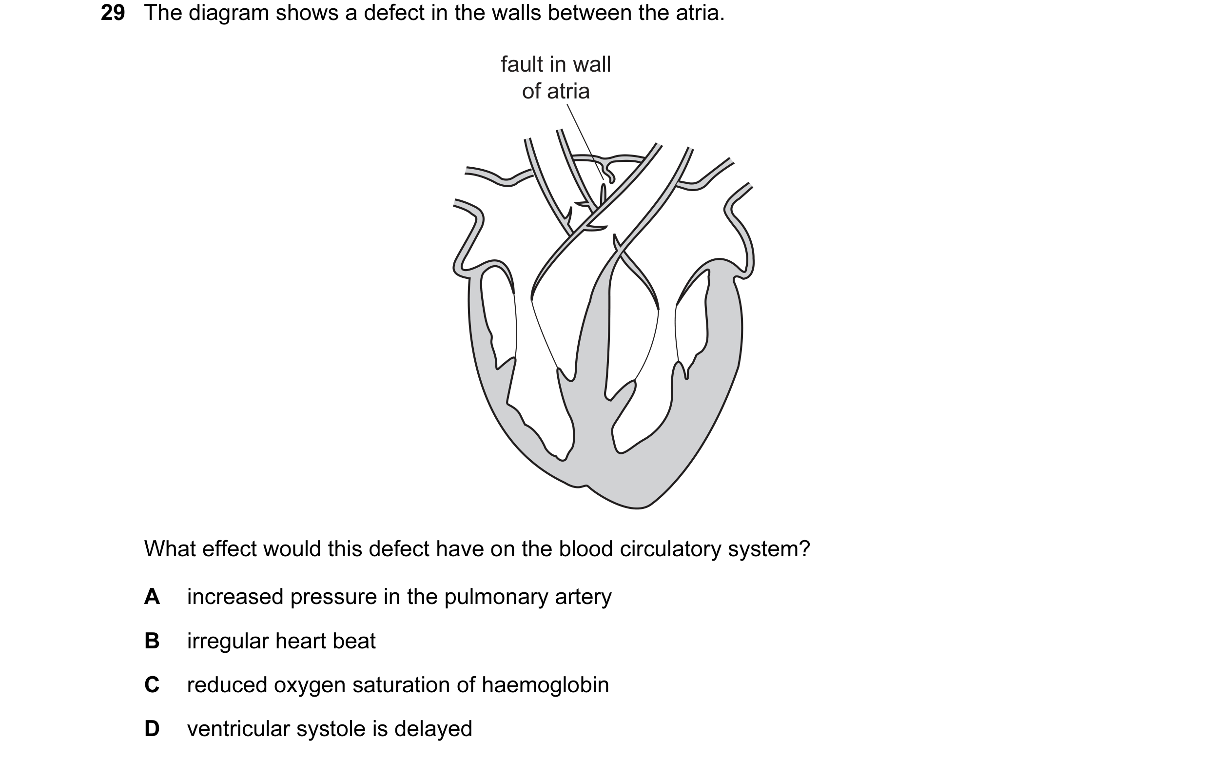 Question 43: The diagram shows a defect in the walls between the atria. fault in wall of atria What effect would this defect have on the blood circulato…