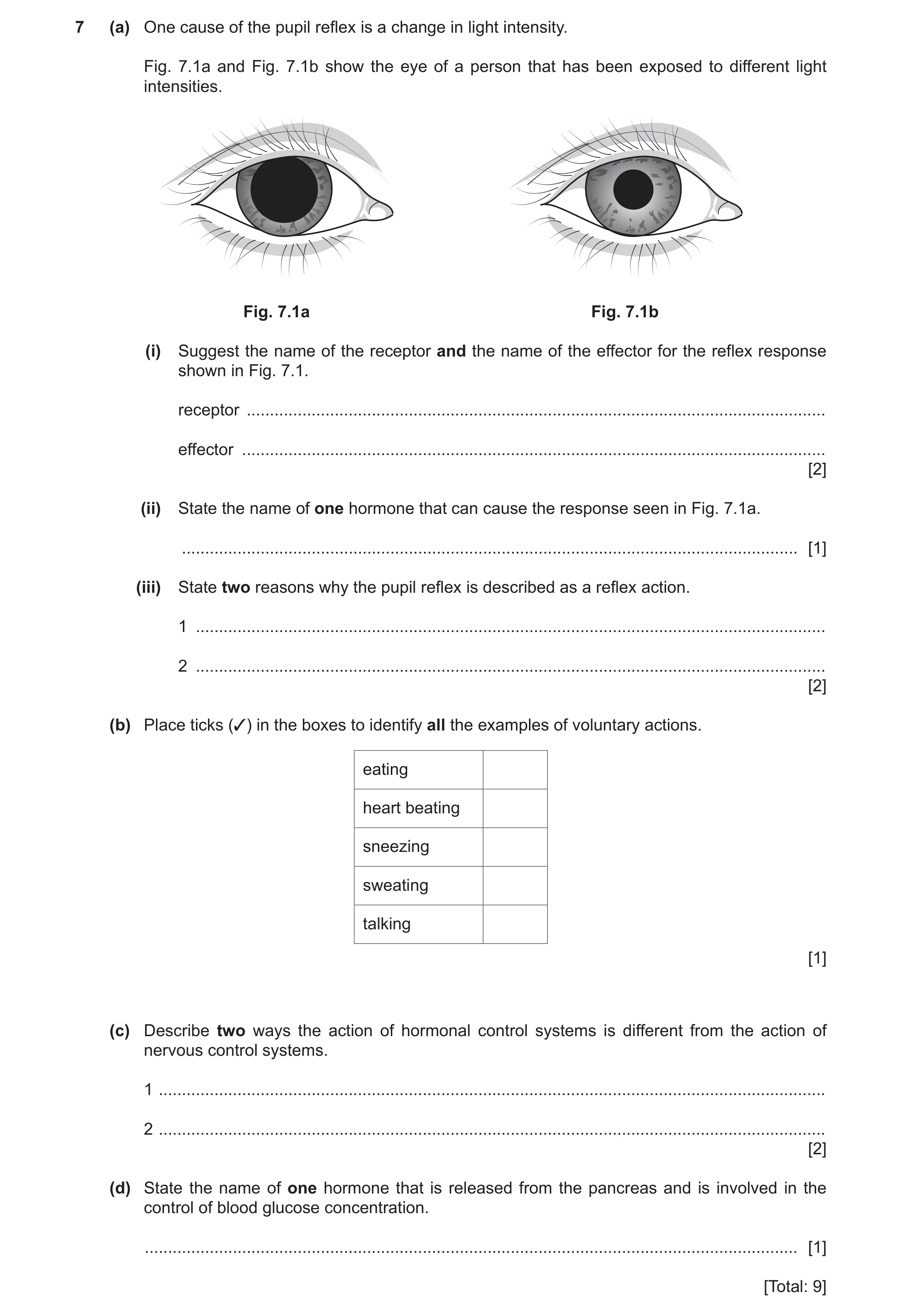 Question 11: (a) One cause of the pupil reflex is a change in light intensity. Fig. 7.1a and Fig. 7.1b show the eye of a person that has been exposed to…