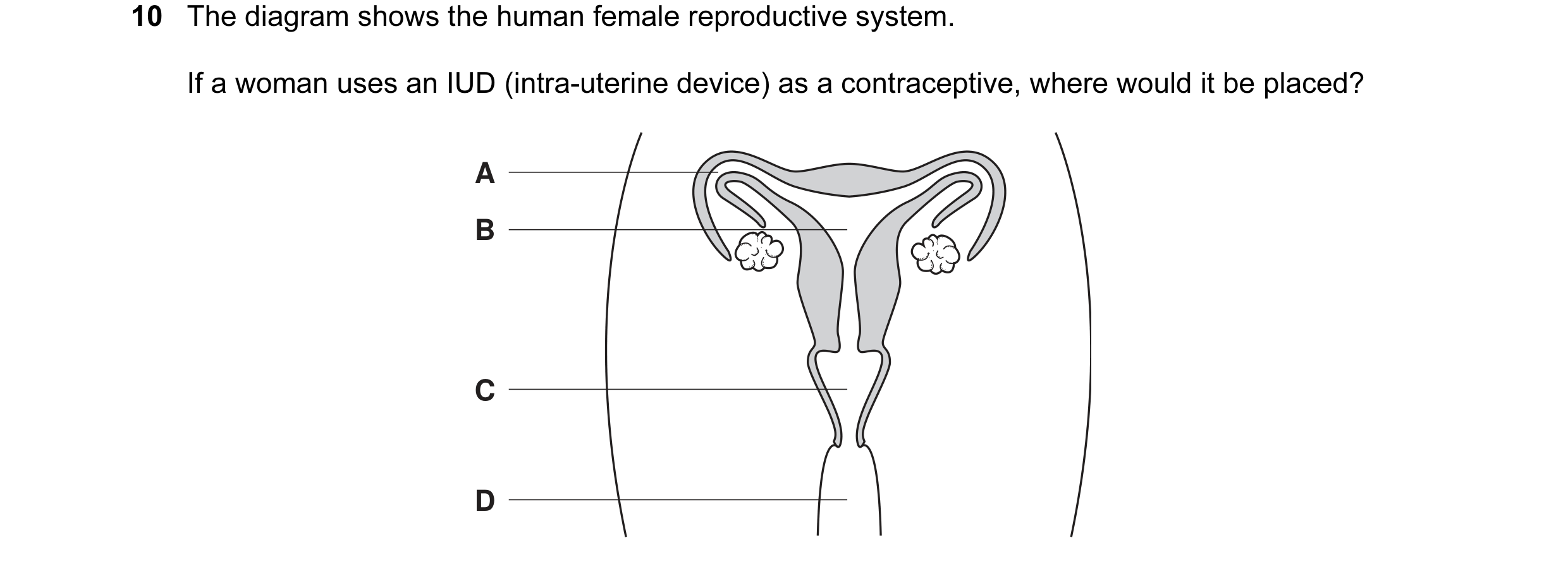 Question 1: The diagram shows the human female reproductive system. If a woman uses an IUD (intra-uterine device) as a contraceptive, where would it be…