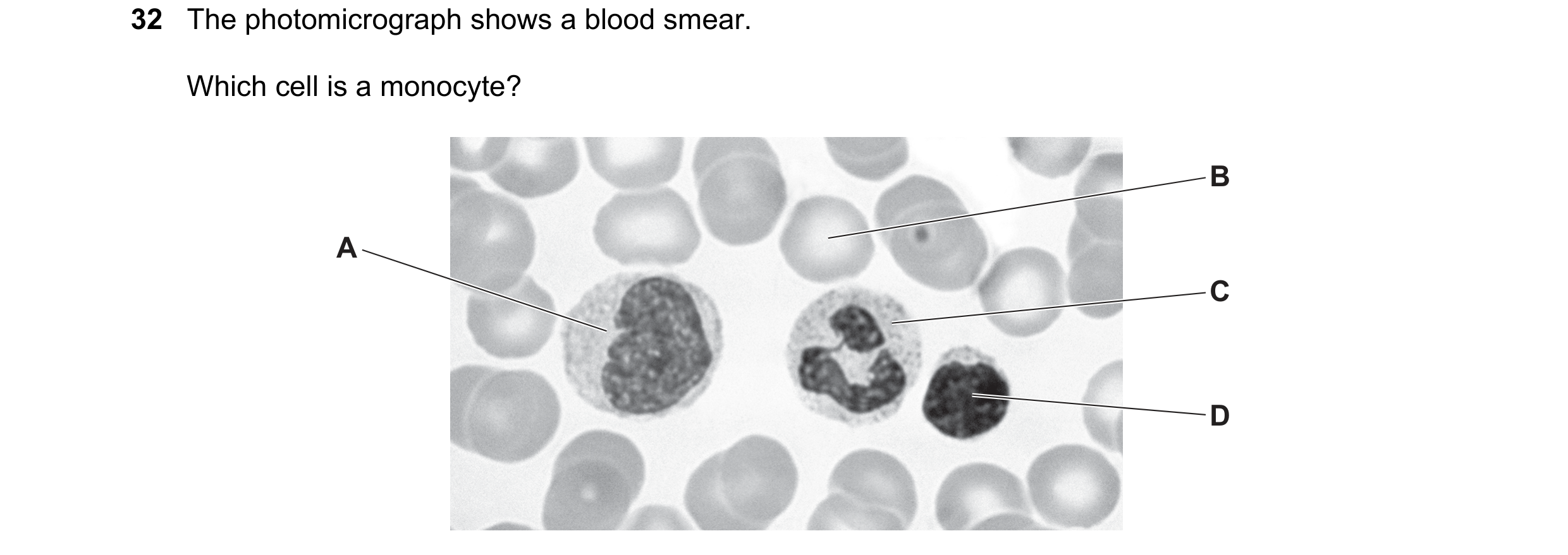 Question 129: The photomicrograph shows a blood smear. Which cell is a monocyte? B A C D