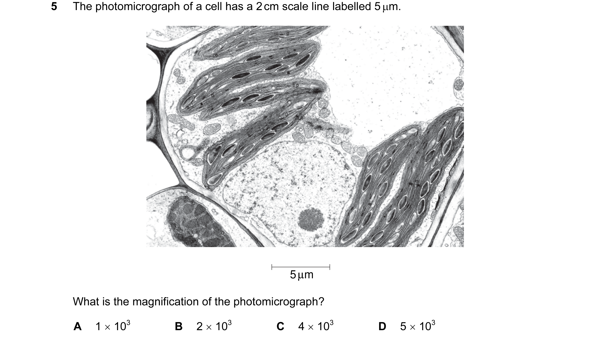 Question 17: The photomicrograph of a cell has a 2 cm scale line labelled 5 µm. 5 µm What is the magnification of the photomicrograph? A 1 × 103 B 2 × 1…