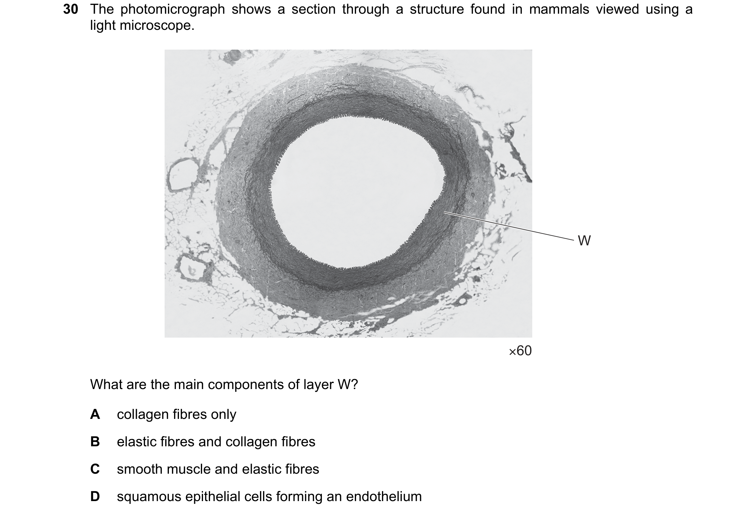 Question 125: The photomicrograph shows a section through a structure found in mammals viewed using a light microscope. W ×60 What are the main component…