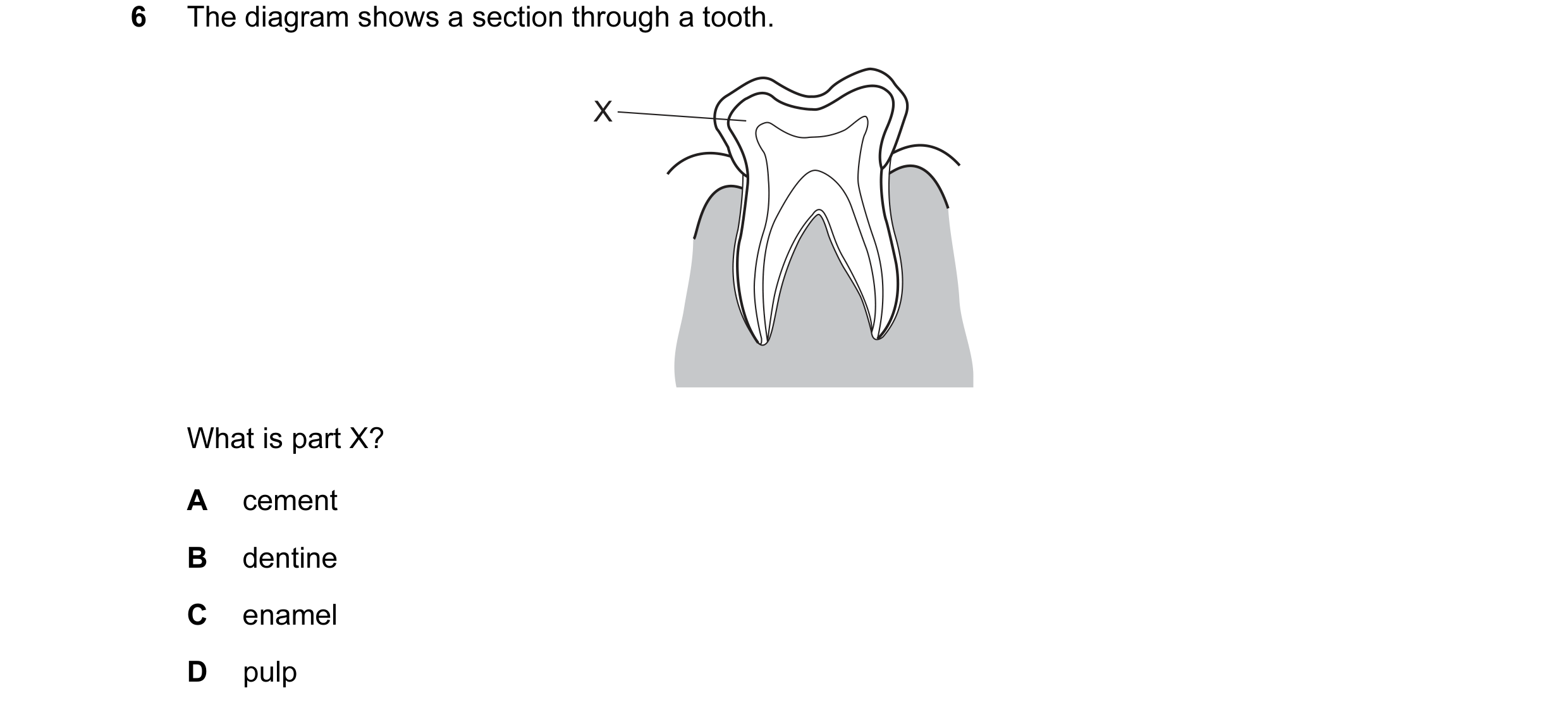 Question 13: The diagram shows a section through a tooth. X What is part X? A cement B dentine C enamel D pulp