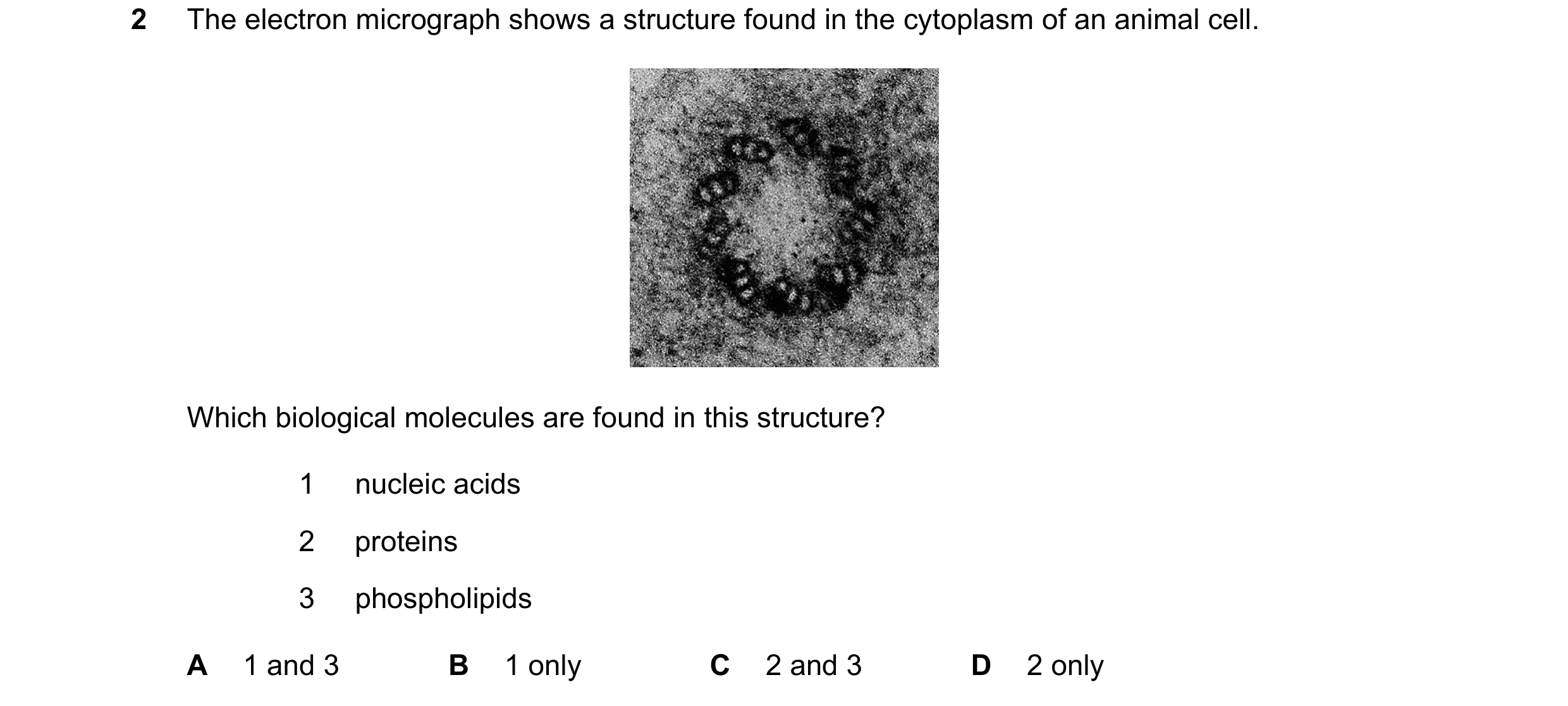 Question 323: The electron micrograph shows a structure found in the cytoplasm of an animal cell. Which biological molecules are found in this structure?…