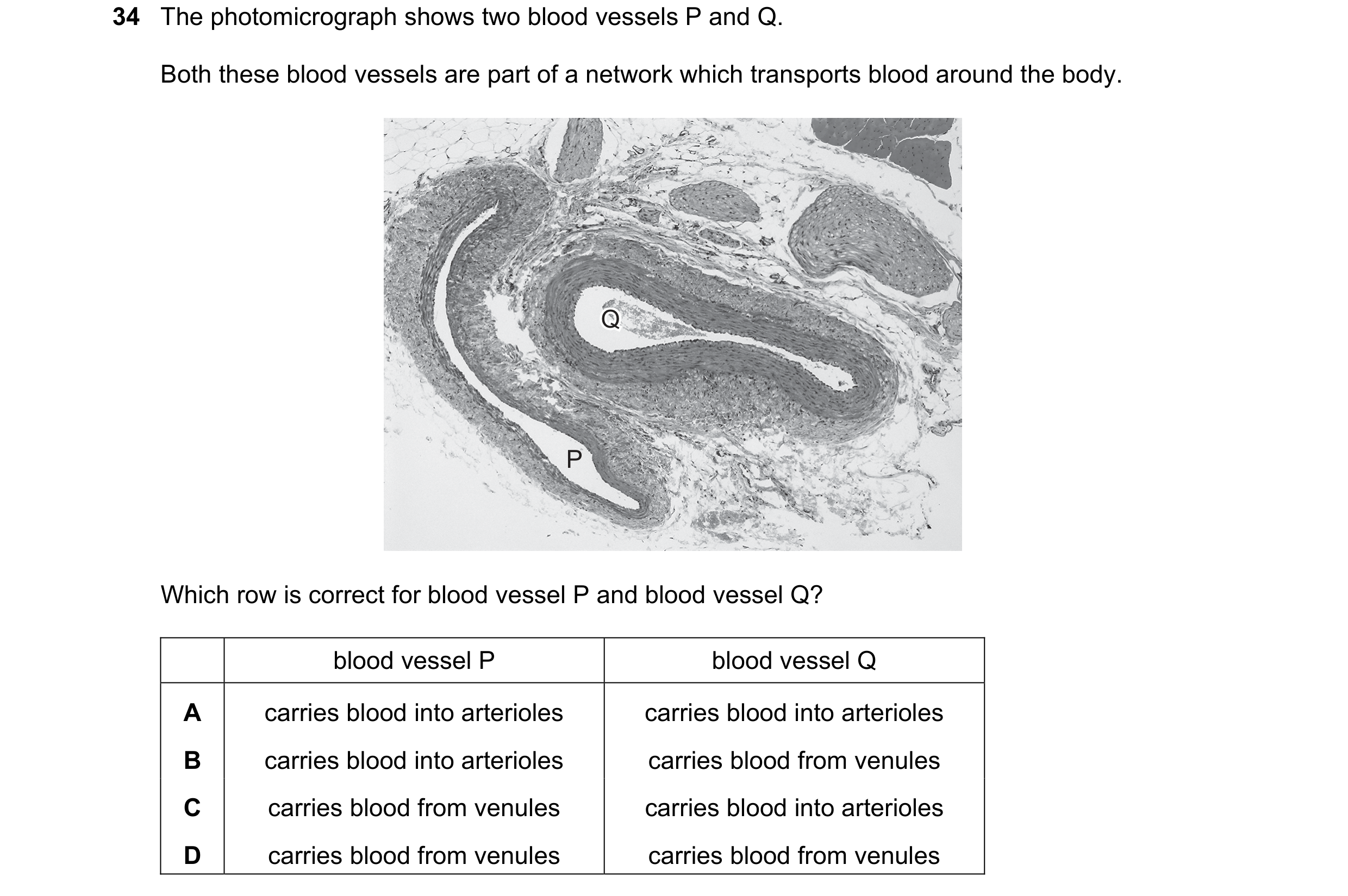 Question 139: The photomicrograph shows two blood vessels P and Q. Both these blood vessels are part of a network which transports blood around the body.…