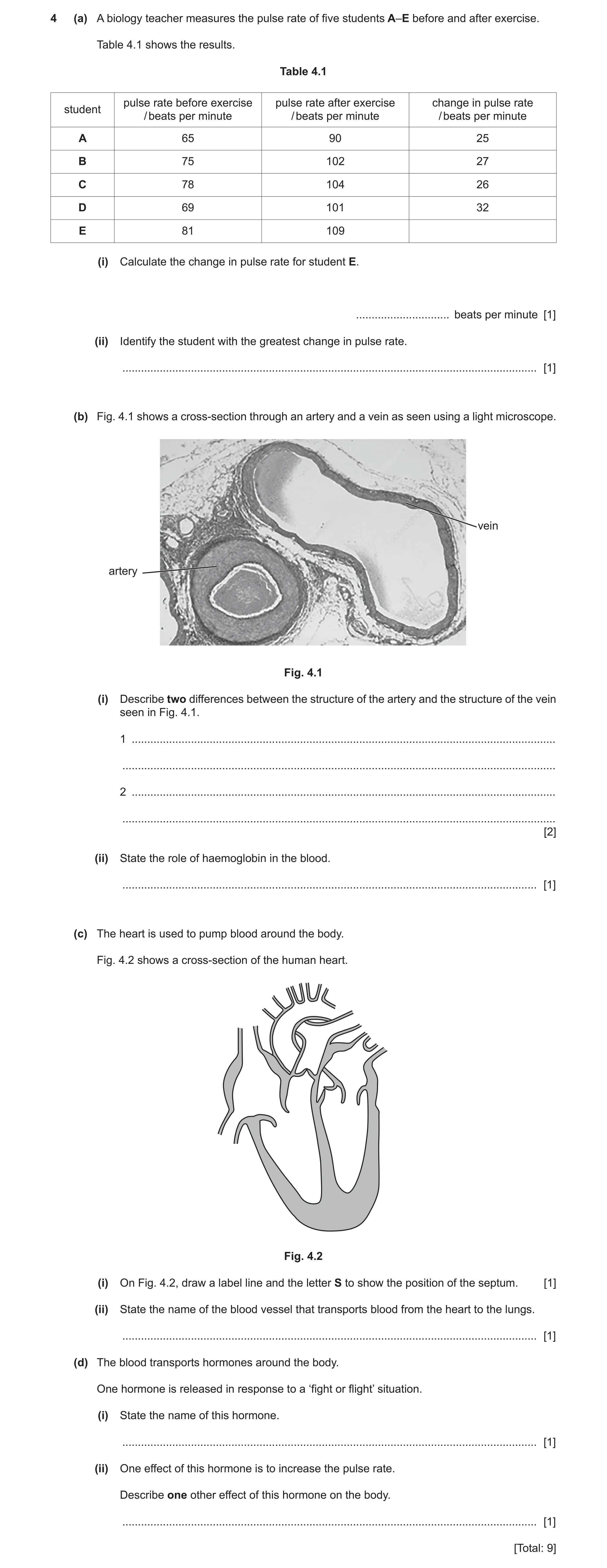 Question 6: (a) A biology teacher measures the pulse rate of five students A–E before and after exercise. Table 4.1 shows the results. Table 4.1 pulse …