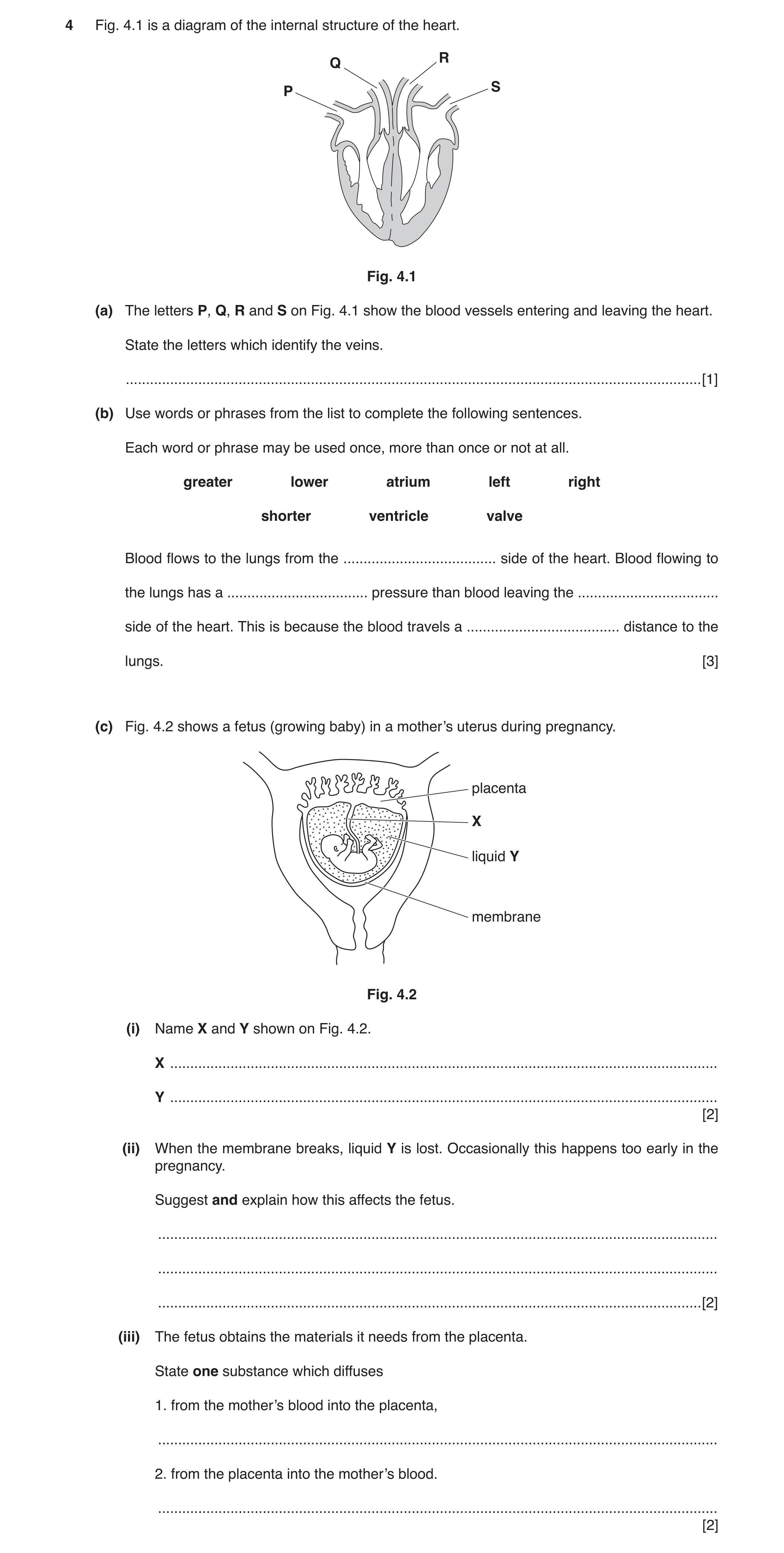Question 3: Fig. 4.1 is a diagram of the internal structure of the heart. R Q S P Fig. 4.1 (a) The letters P, Q, R and S on Fig. 4.1 show the blood ves…